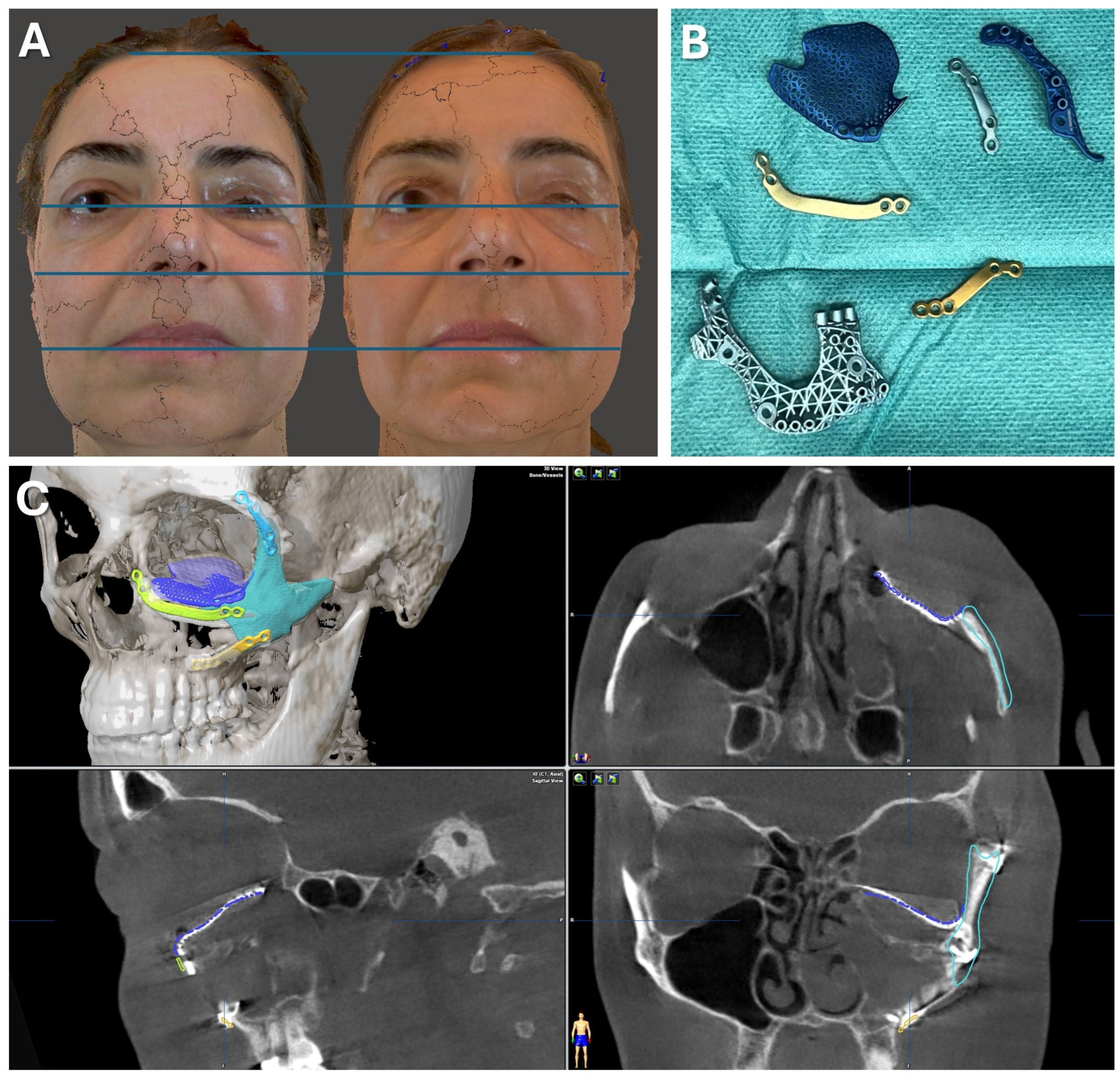 Jcm 13 05196 g007 Jcm 13 05196 g007