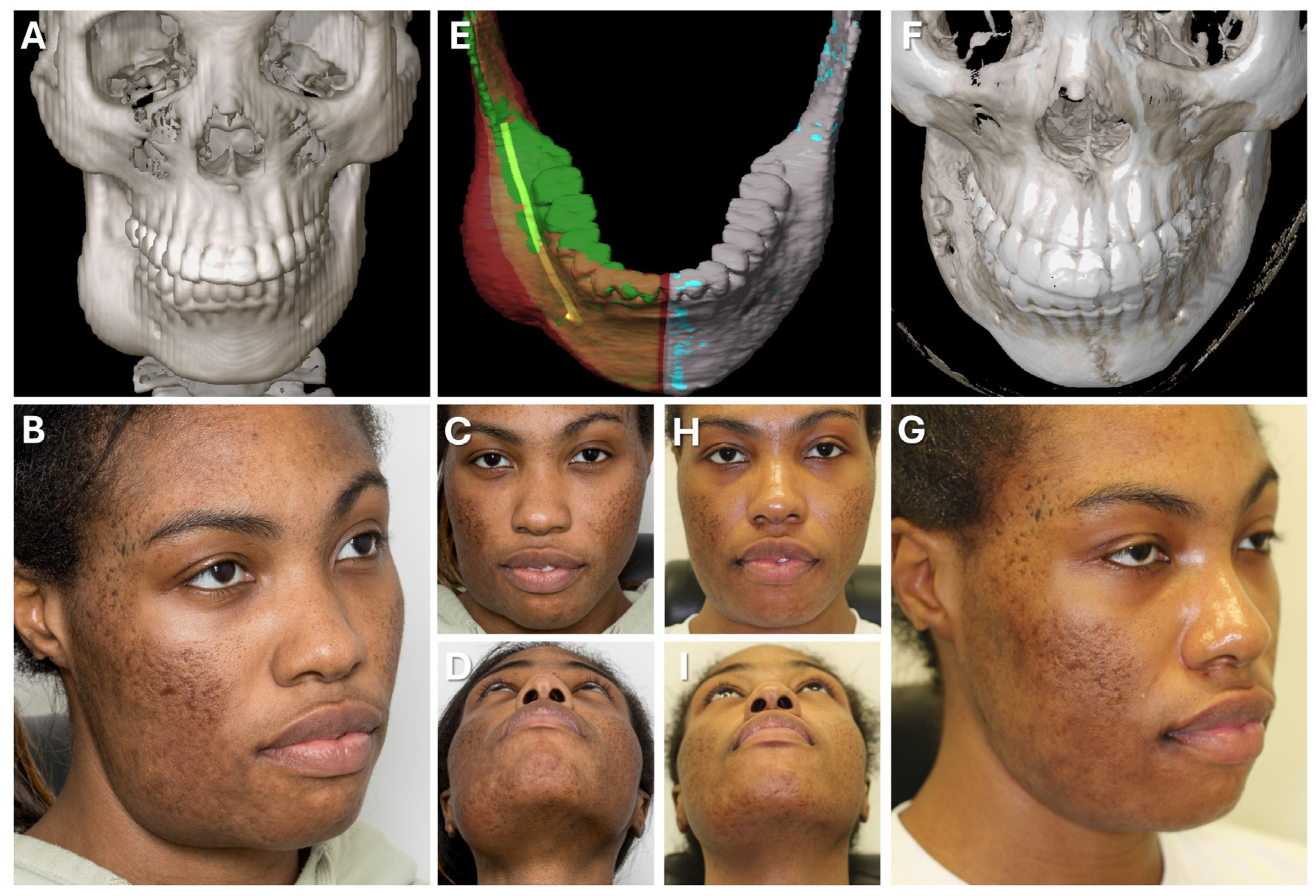 Jcm 13 05196 g009 Jcm 13 05196 g009