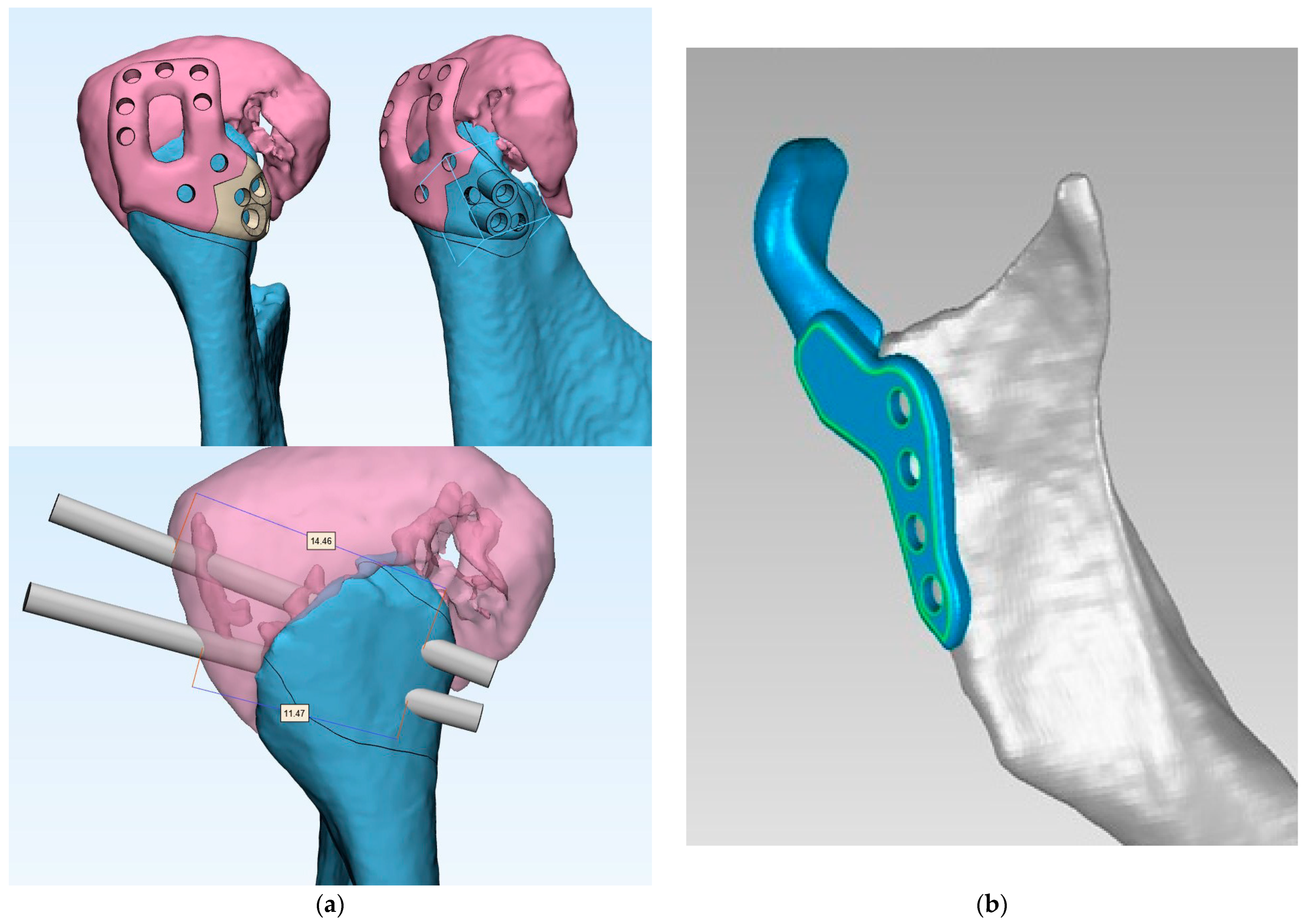Jcm 13 05257 g002 Jcm 13 05257 g002