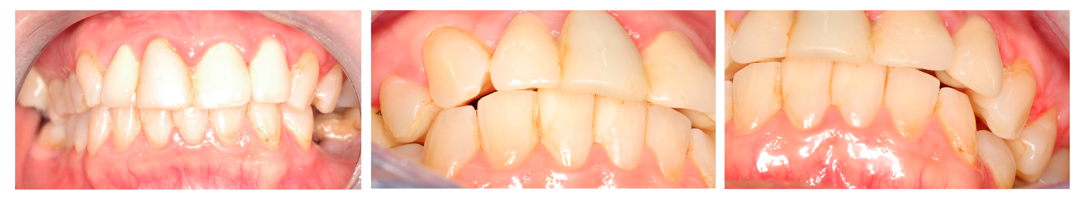 Jcm 13 05257 g005 Jcm 13 05257 g005