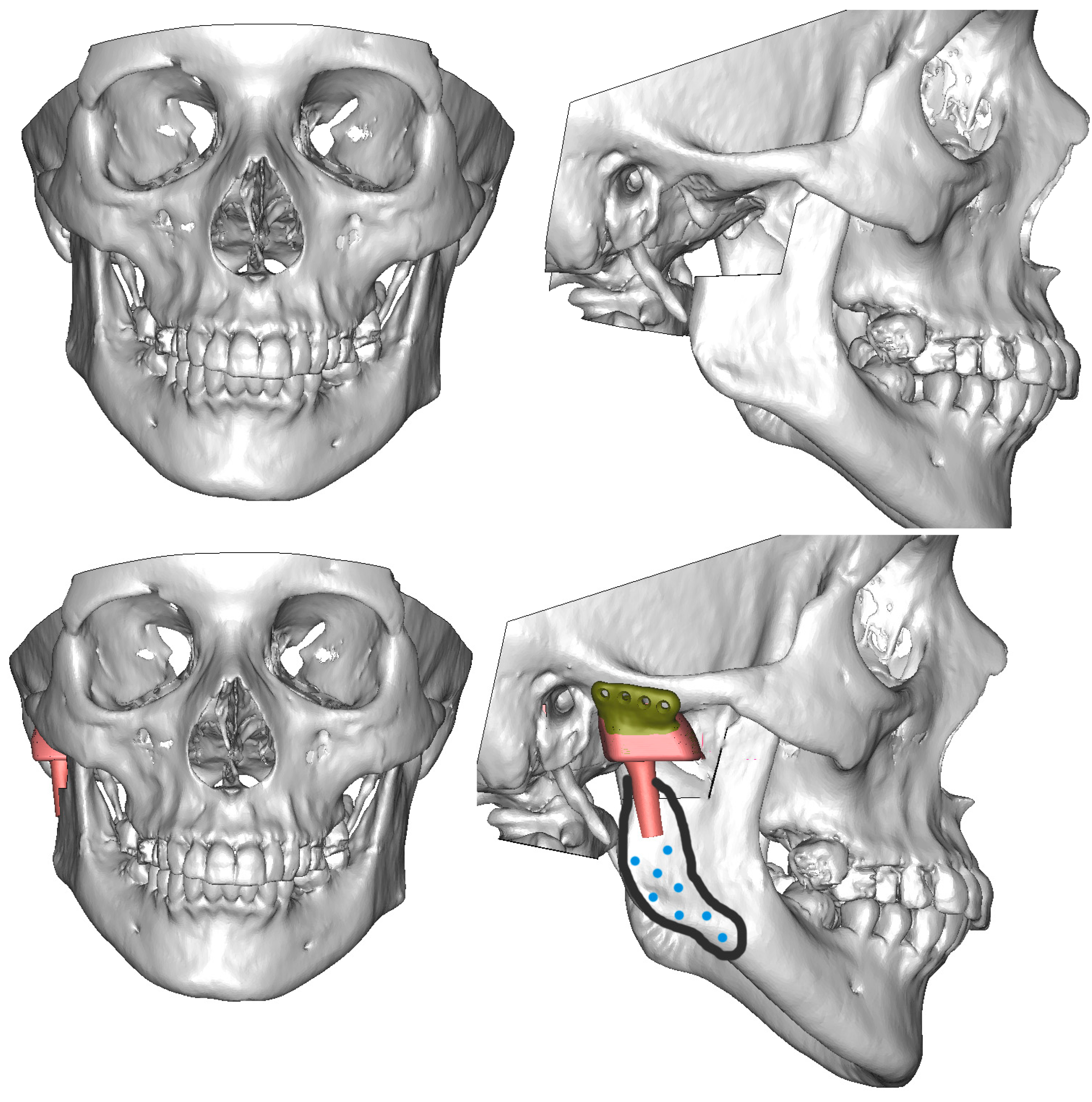 Jcm 13 05257 g007 Jcm 13 05257 g007