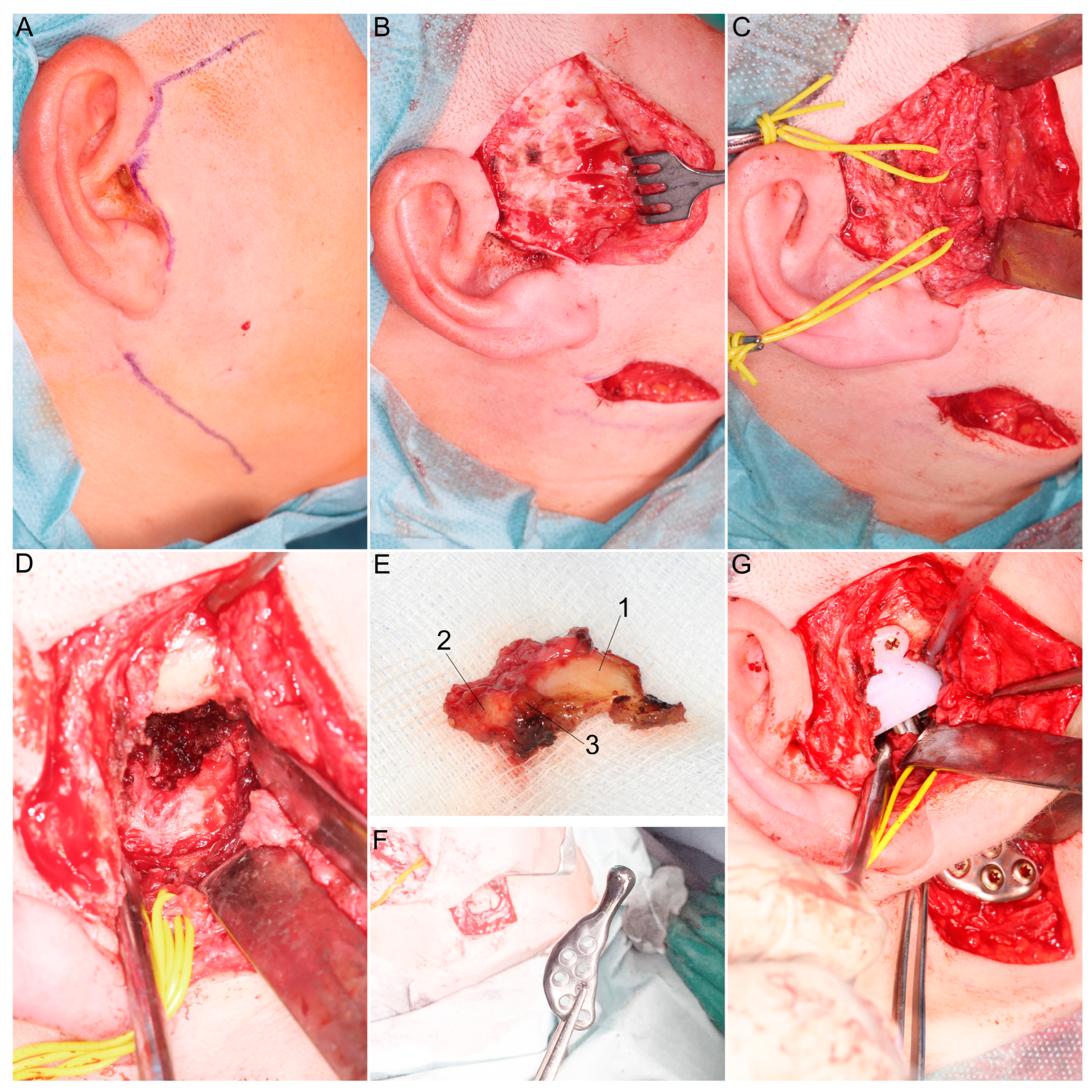 Jcm 13 05257 g009 Jcm 13 05257 g009