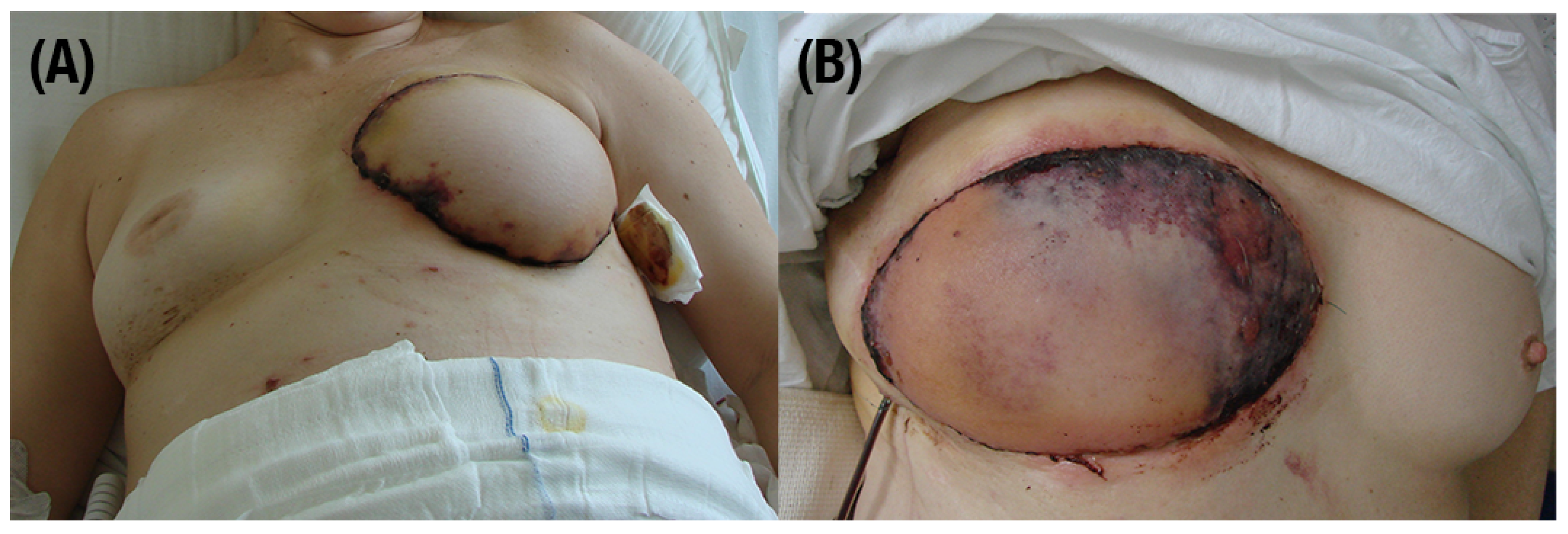 Jcm 13 05467 g003 Jcm 13 05467 g003