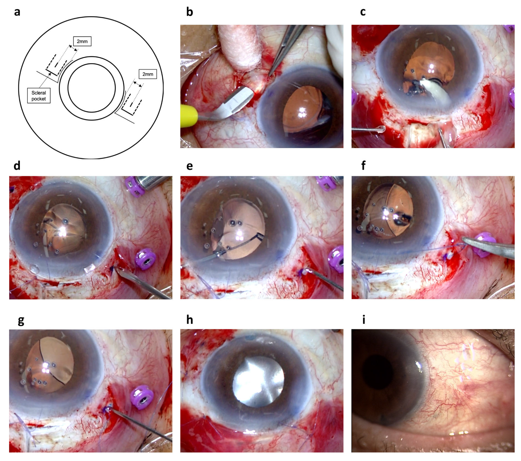 Jcm 13 05522 g001 Jcm 13 05522 g001
