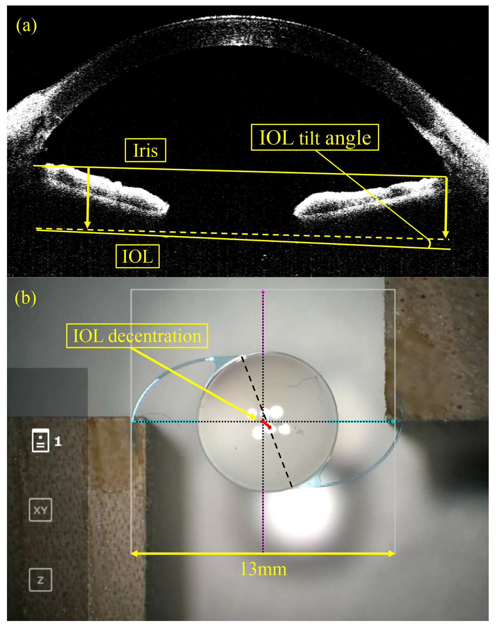 Jcm 13 05522 g003 Jcm 13 05522 g003