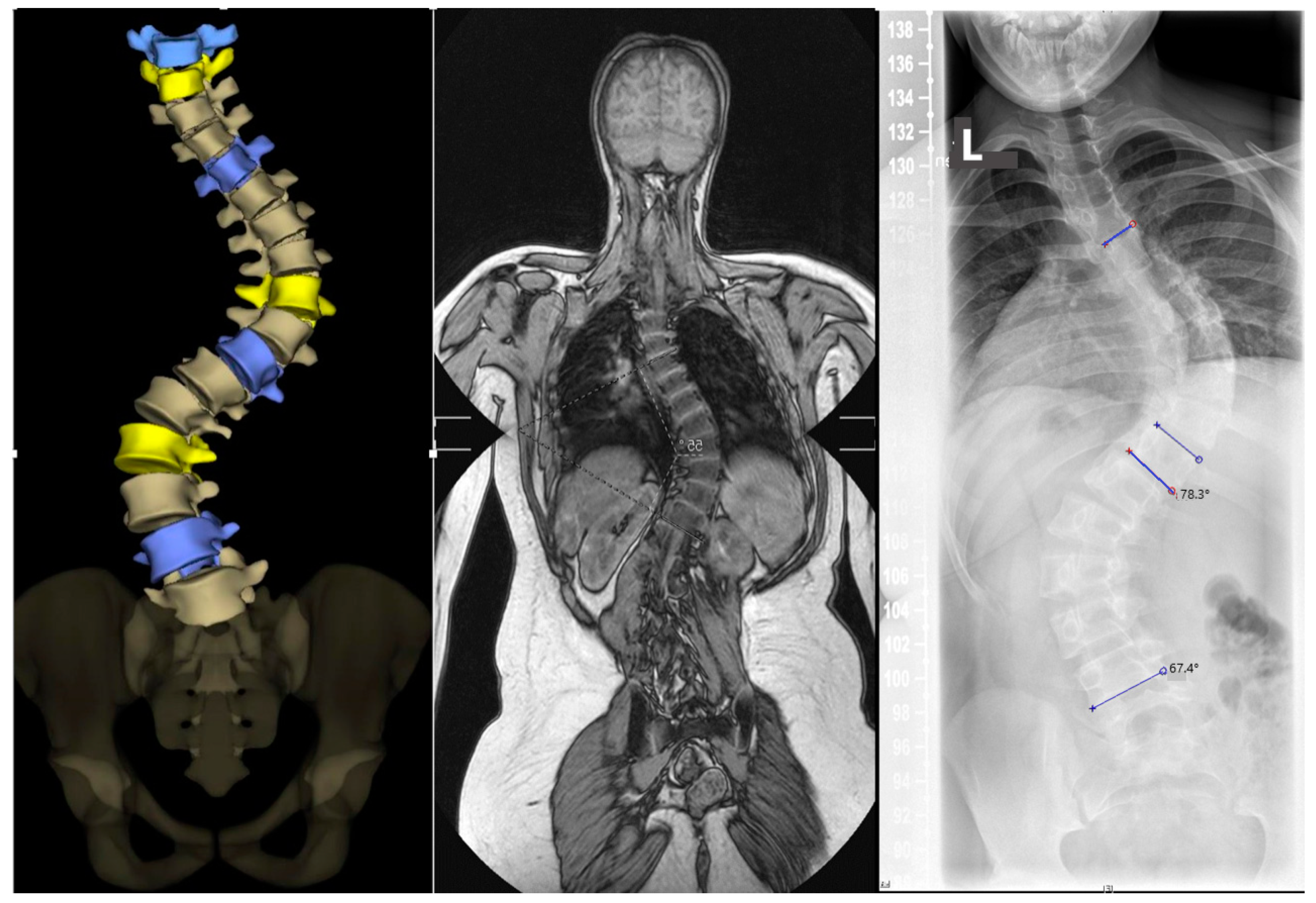 Jcm 13 05768 g002 Jcm 13 05768 g002