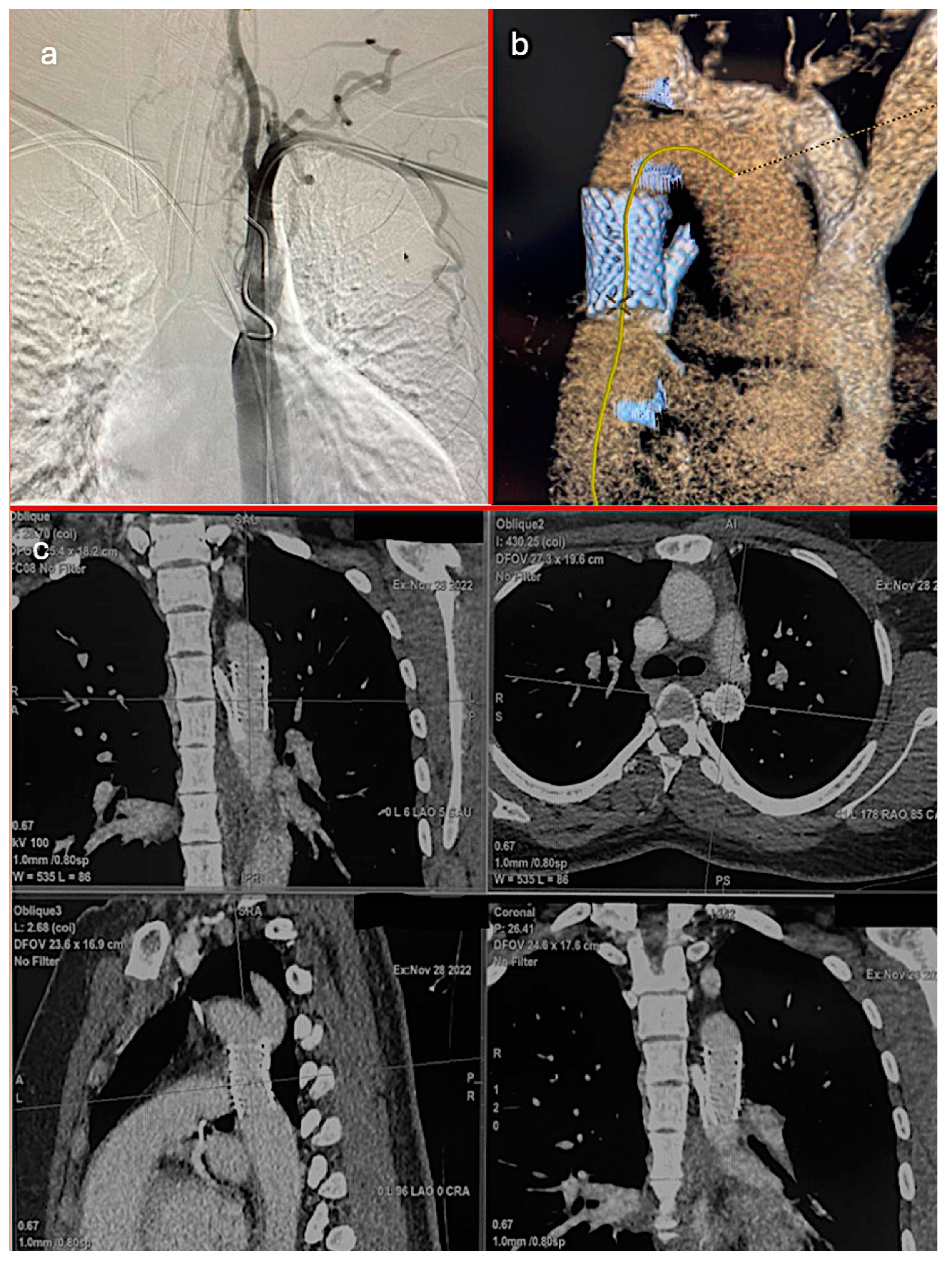Jcm 13 05814 g002 Jcm 13 05814 g002