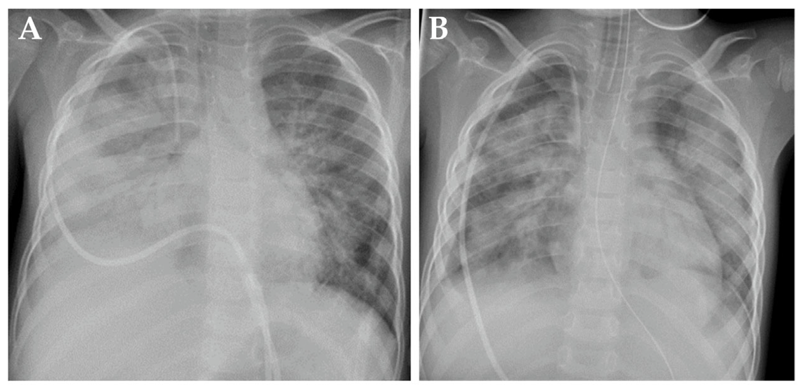 Jcm 13 05995 g002 Jcm 13 05995 g002