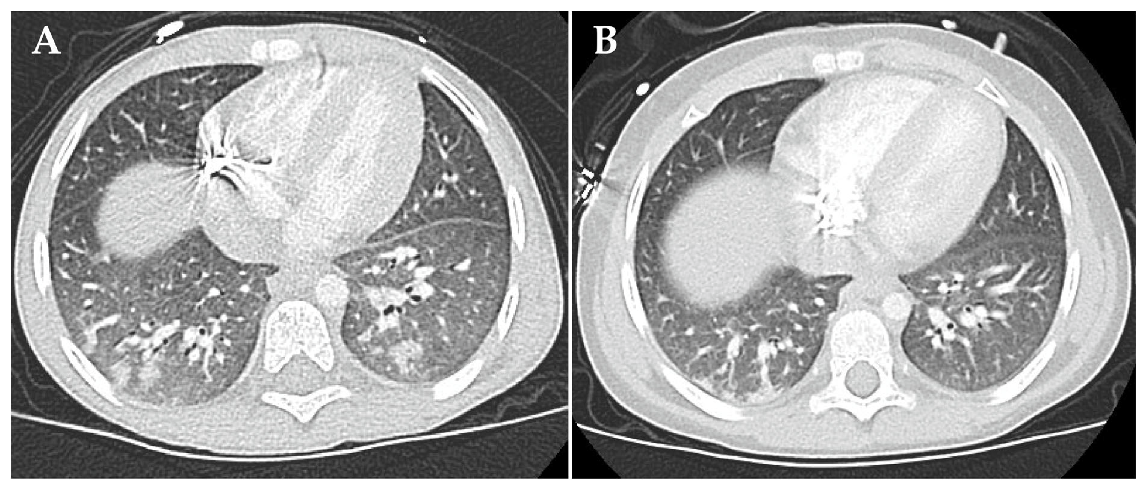 Jcm 13 05995 g005 Jcm 13 05995 g005