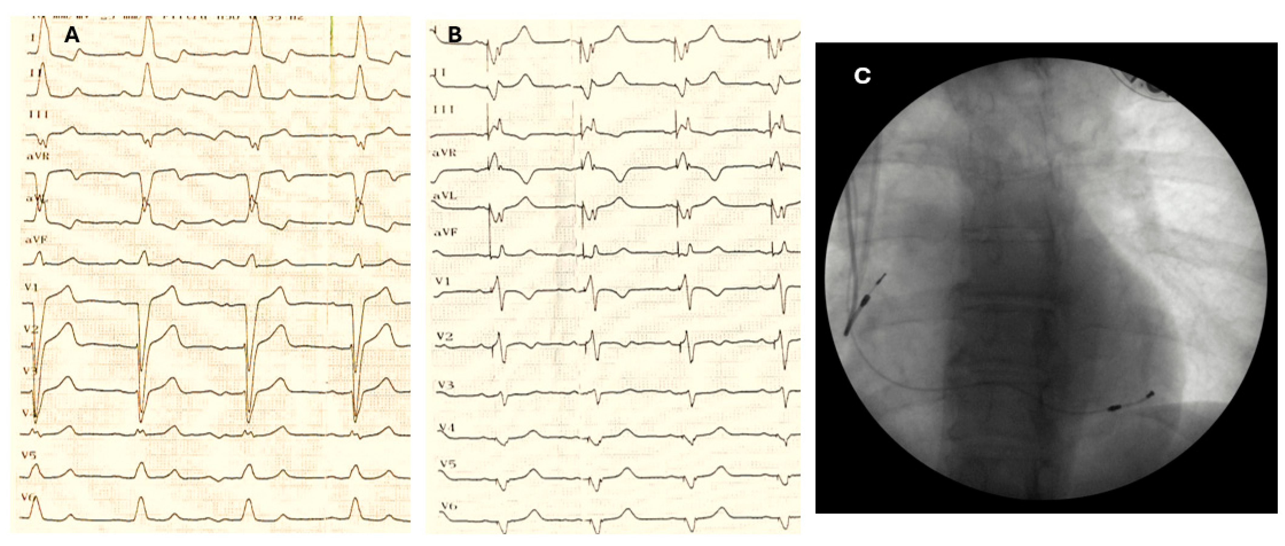 Jcm 13 06365 g001 Jcm 13 06365 g001
