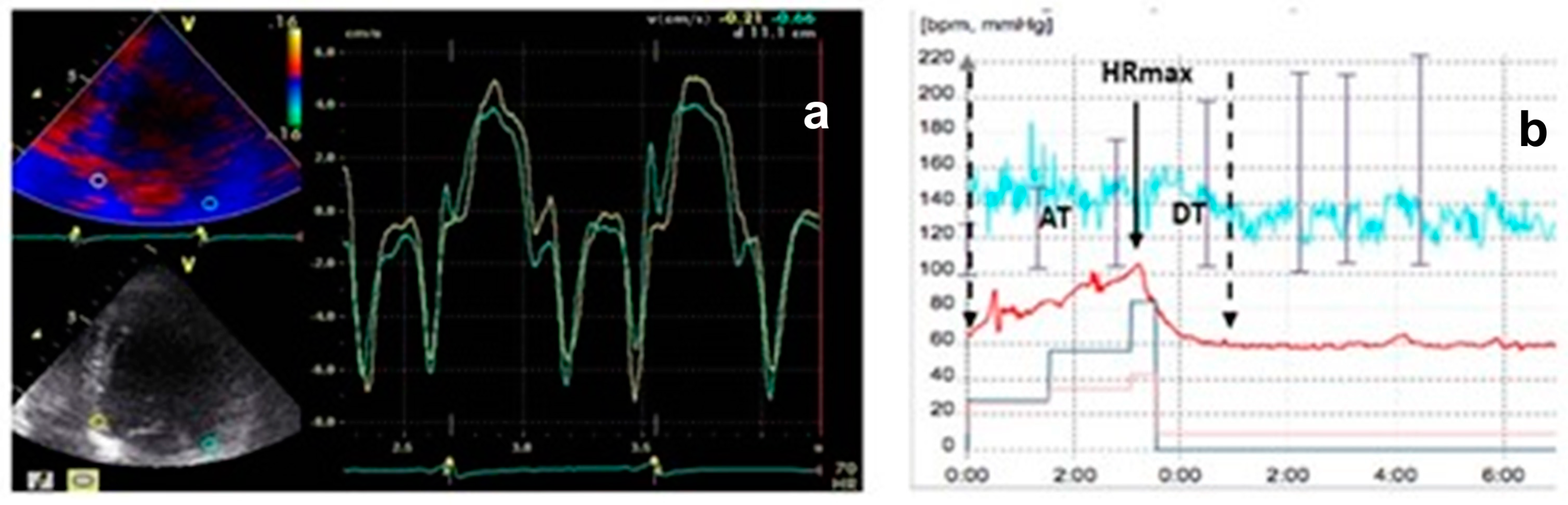 Jcm 13 06365 g004 Jcm 13 06365 g004