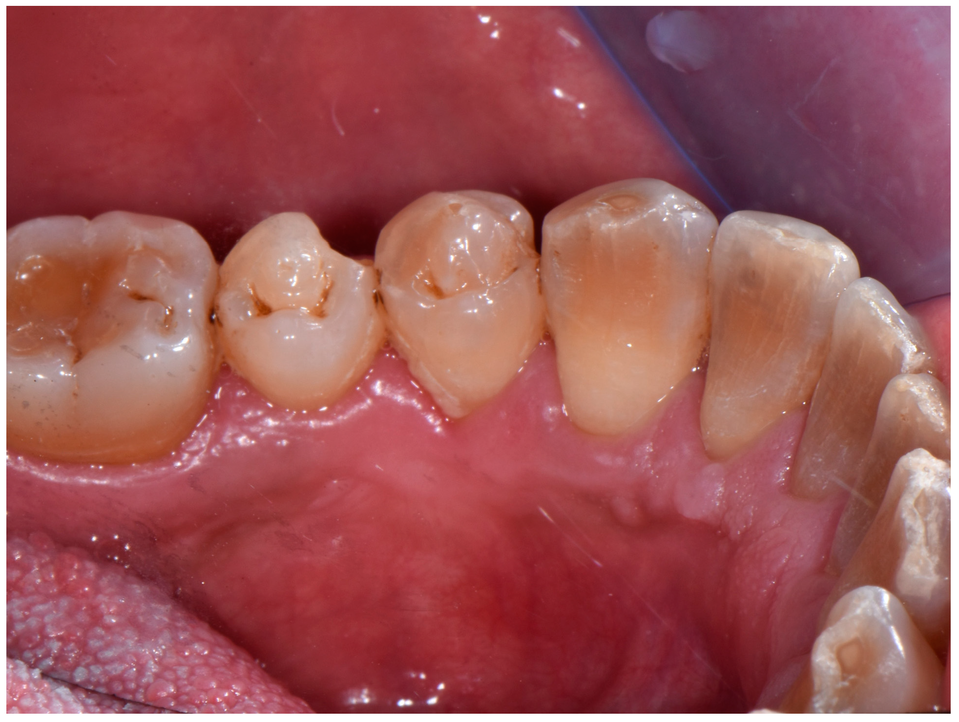 Jcm 13 06714 g004 Jcm 13 06714 g004