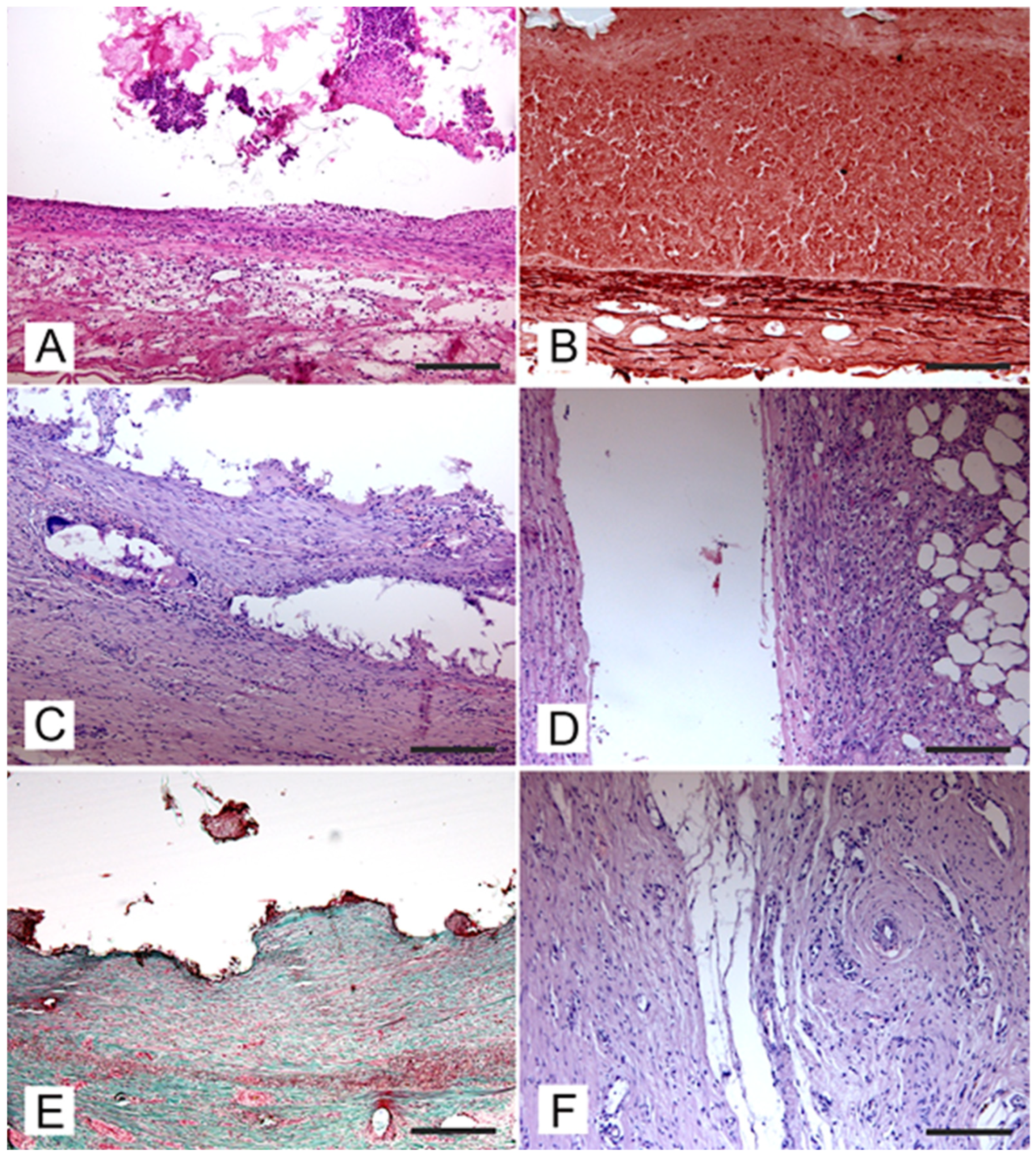 Jcm 13 07222 g004 Jcm 13 07222 g004