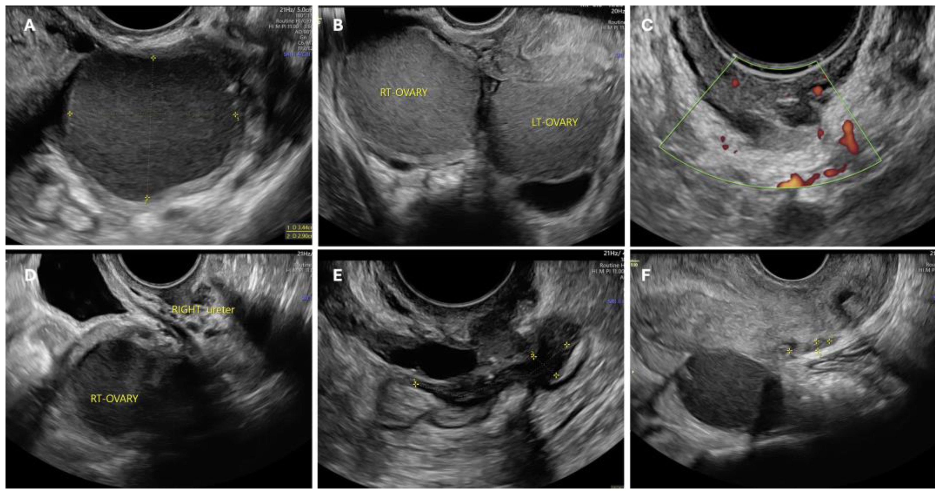 Jcm 13 07349 g002 Jcm 13 07349 g002