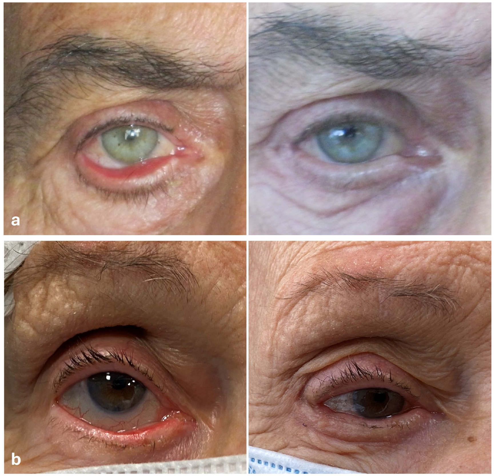 Jcm 14 00128 g002 Jcm 14 00128 g002