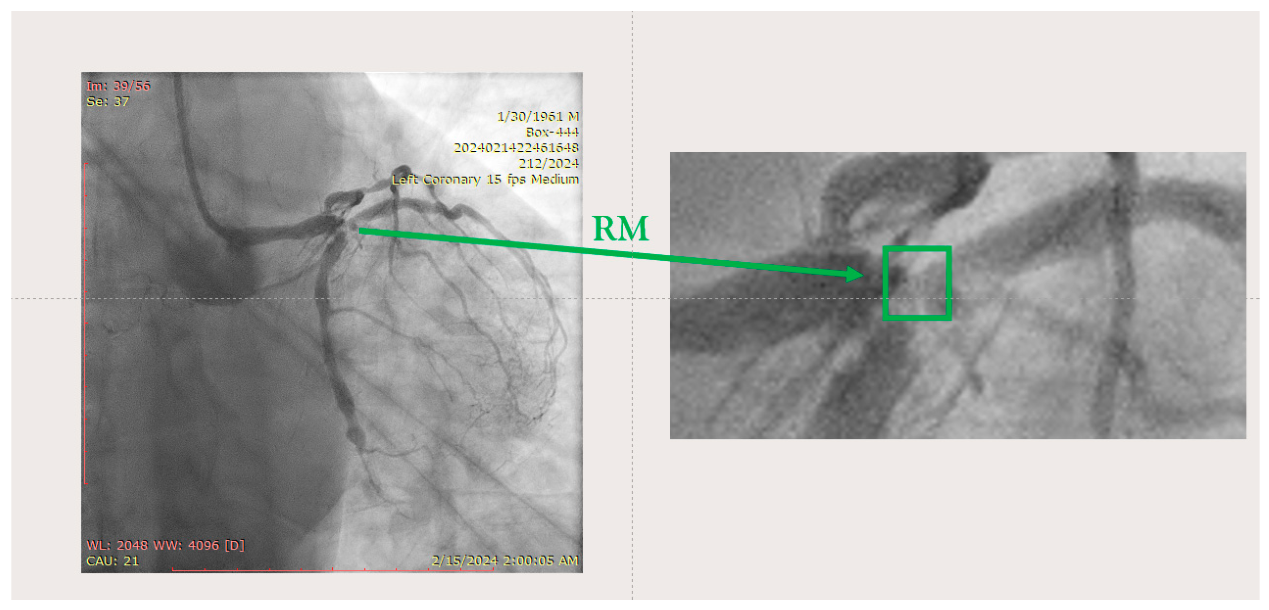 Jcm 14 00328 g005 Jcm 14 00328 g005