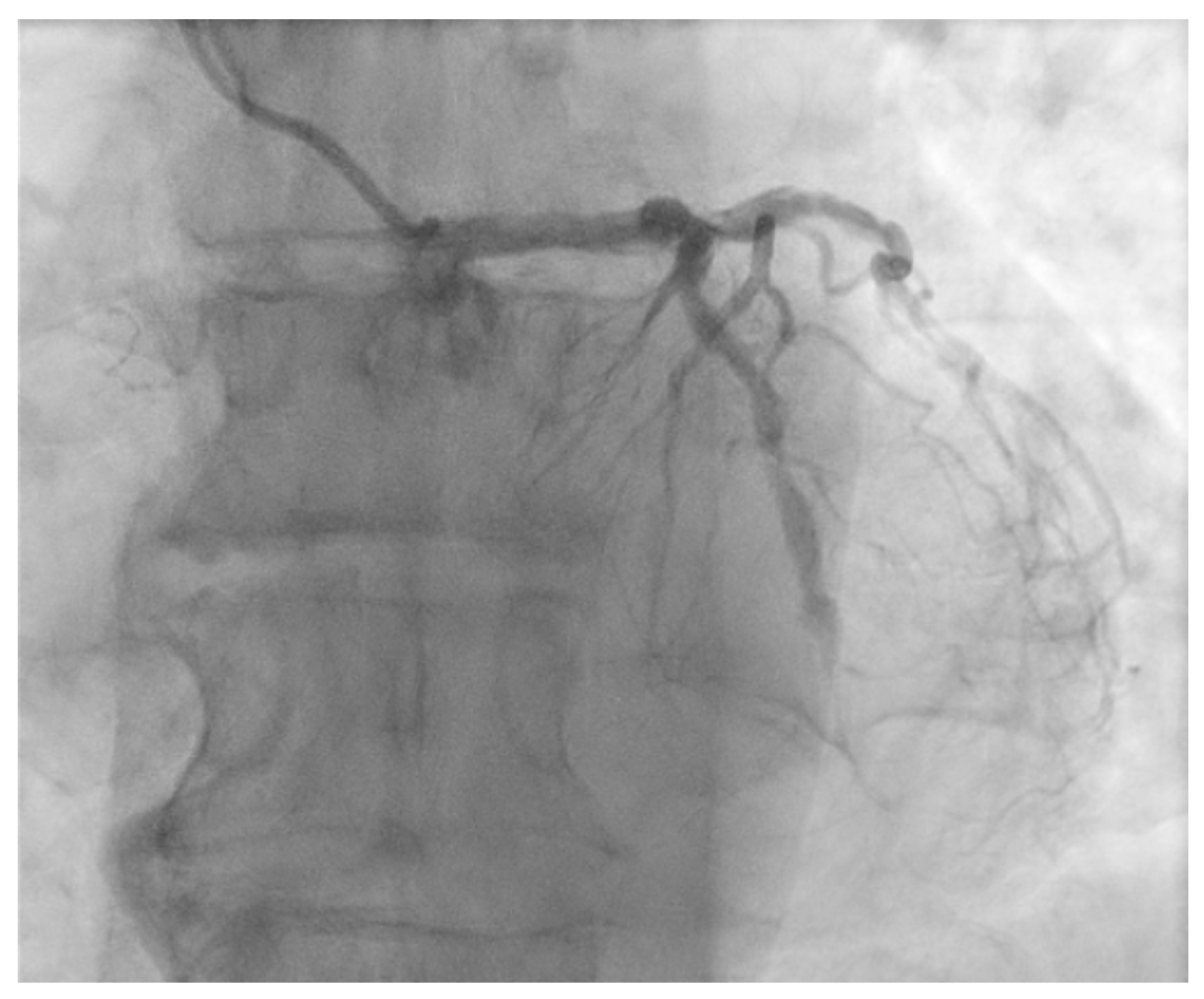 Jcm 14 00328 g007 Jcm 14 00328 g007