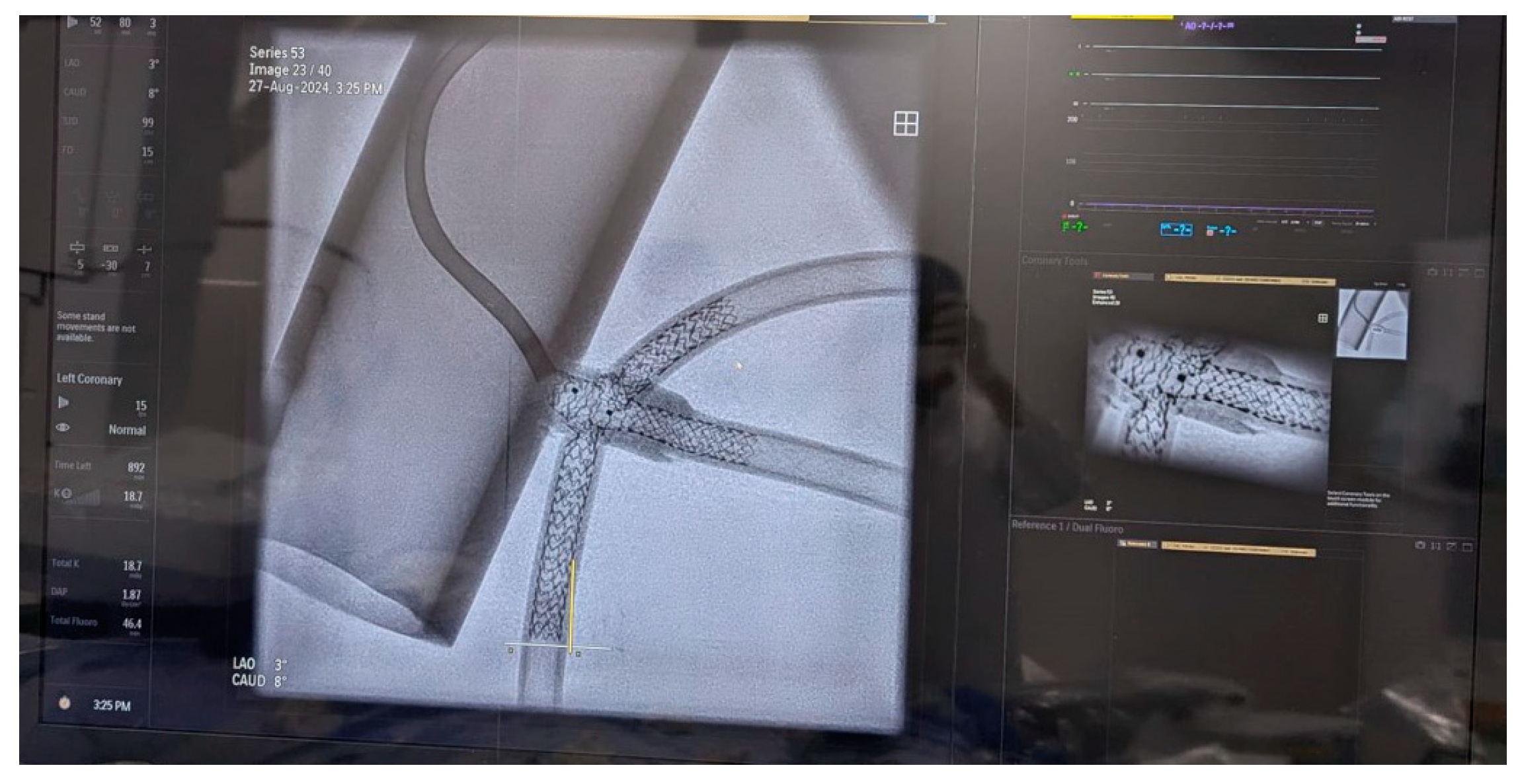 Jcm 14 00328 g013 Jcm 14 00328 g013