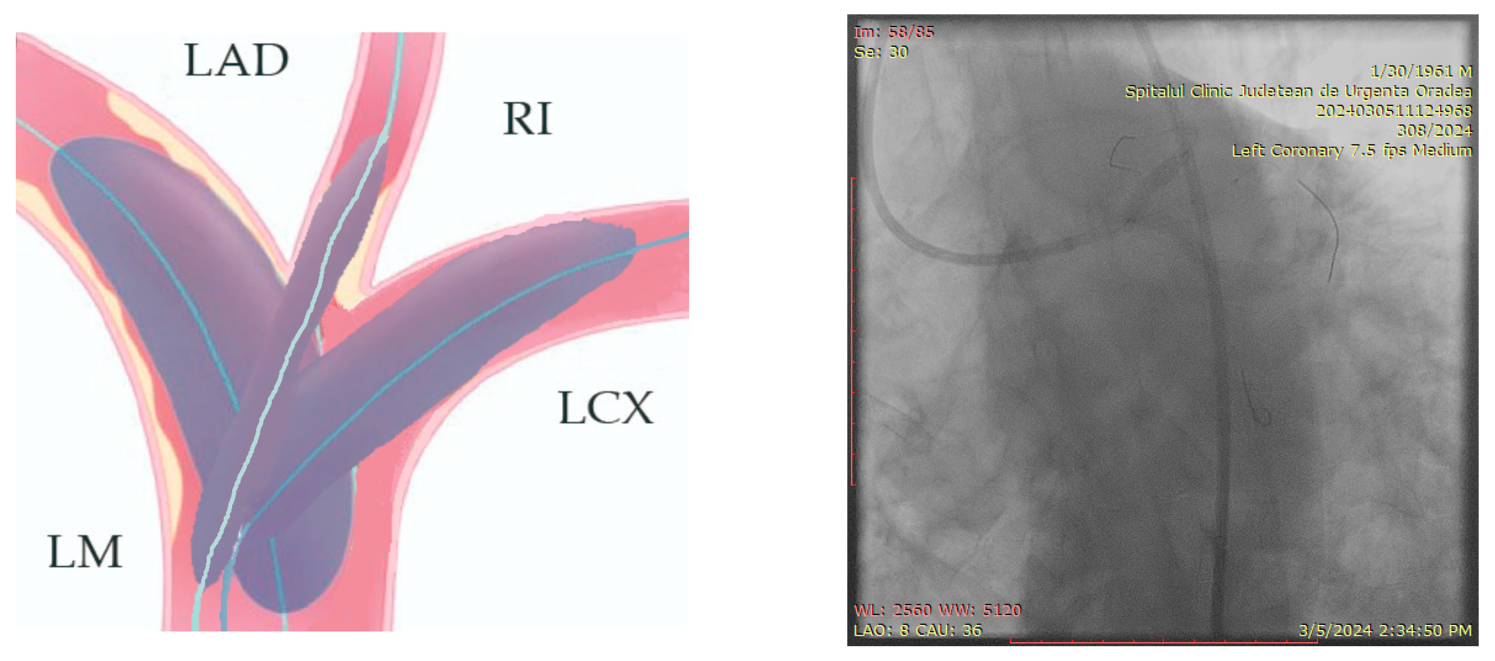 Jcm 14 00328 g015 Jcm 14 00328 g015
