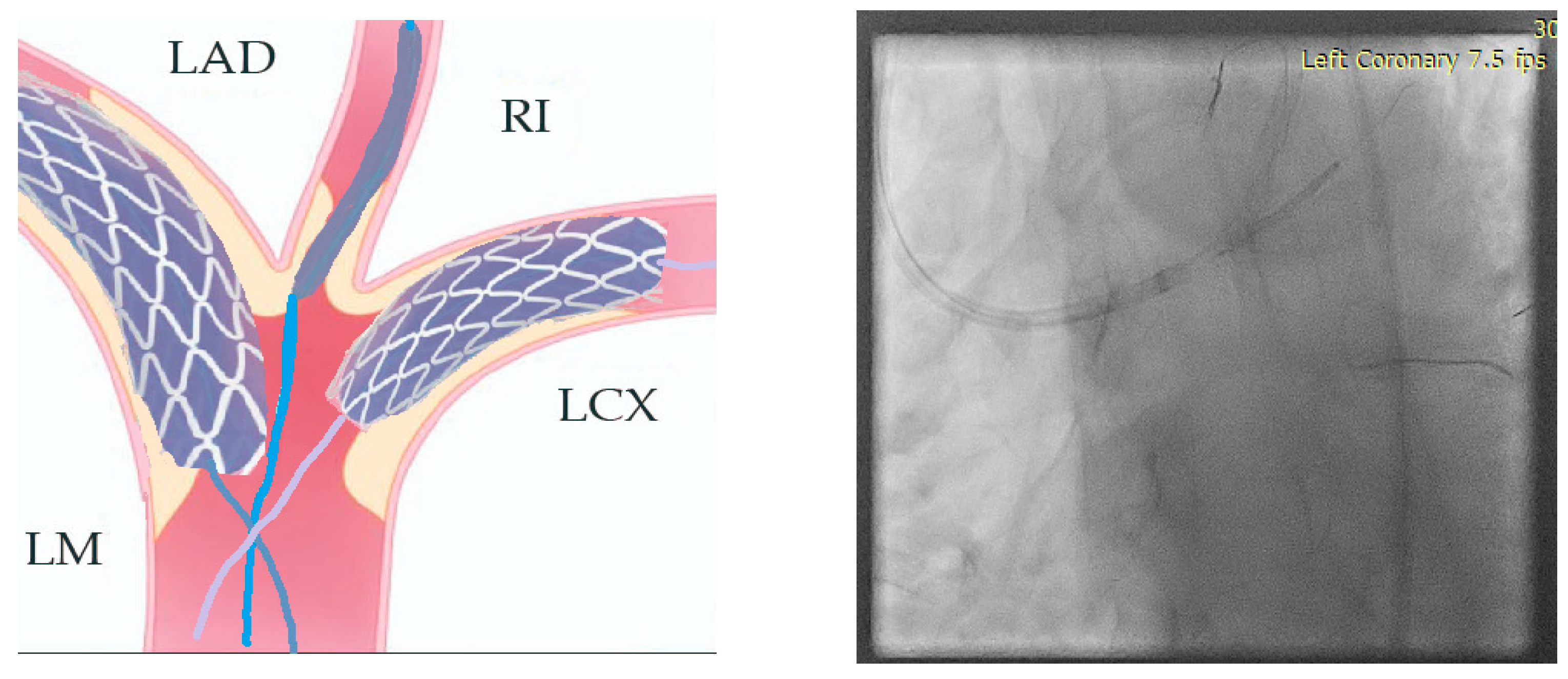 Jcm 14 00328 g016 Jcm 14 00328 g016