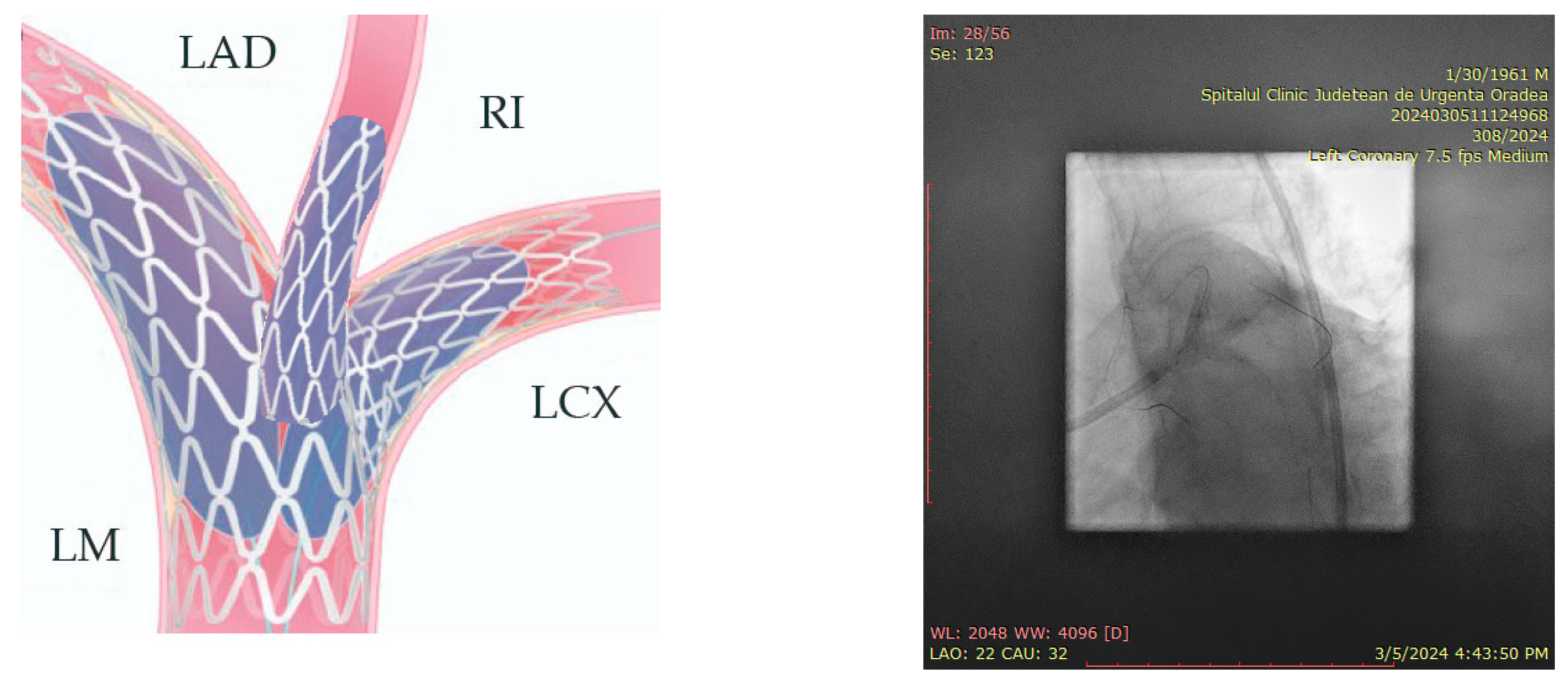 Jcm 14 00328 g022 Jcm 14 00328 g022