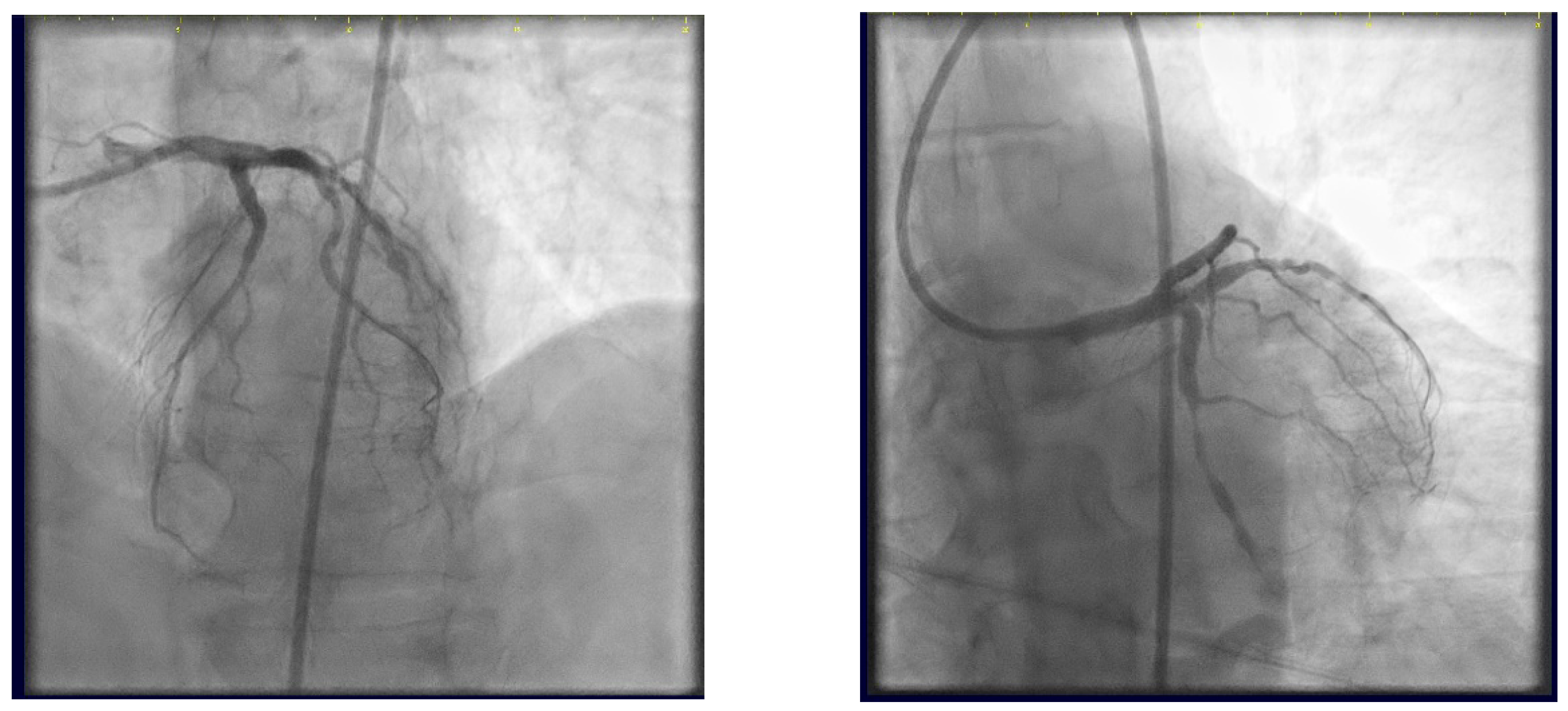 Jcm 14 00328 g024 Jcm 14 00328 g024