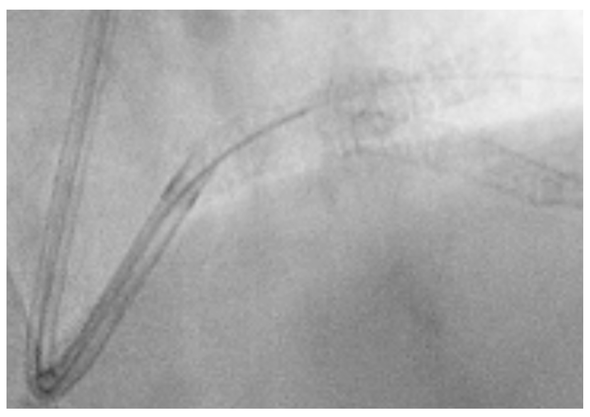 Jcm 14 00328 g025 Jcm 14 00328 g025