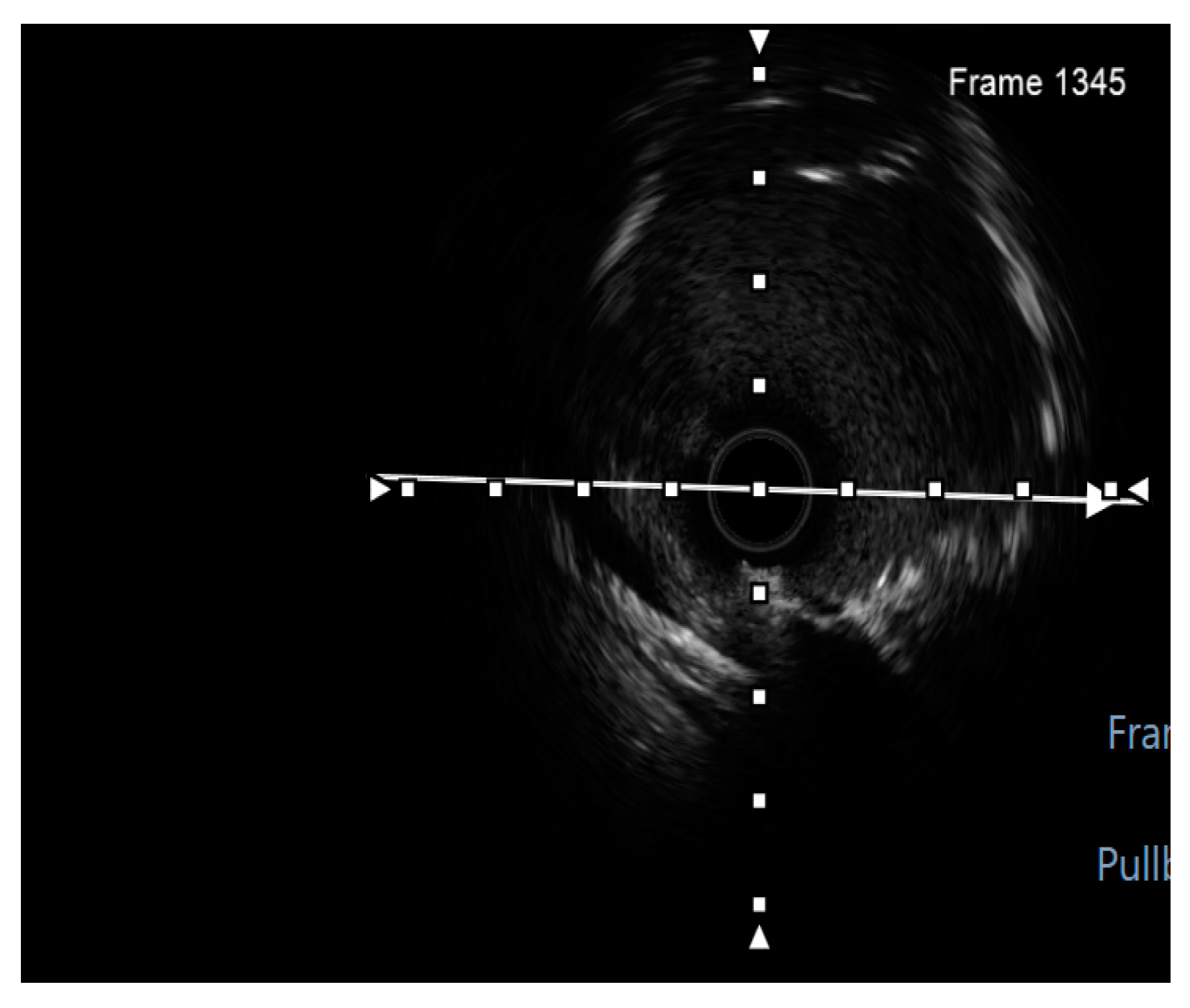 Jcm 14 00328 g026 Jcm 14 00328 g026