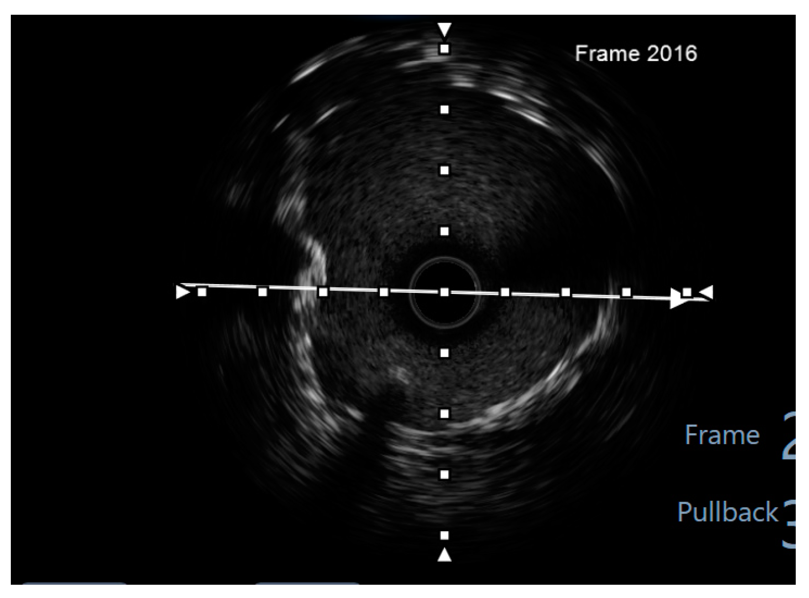 Jcm 14 00328 g028 Jcm 14 00328 g028
