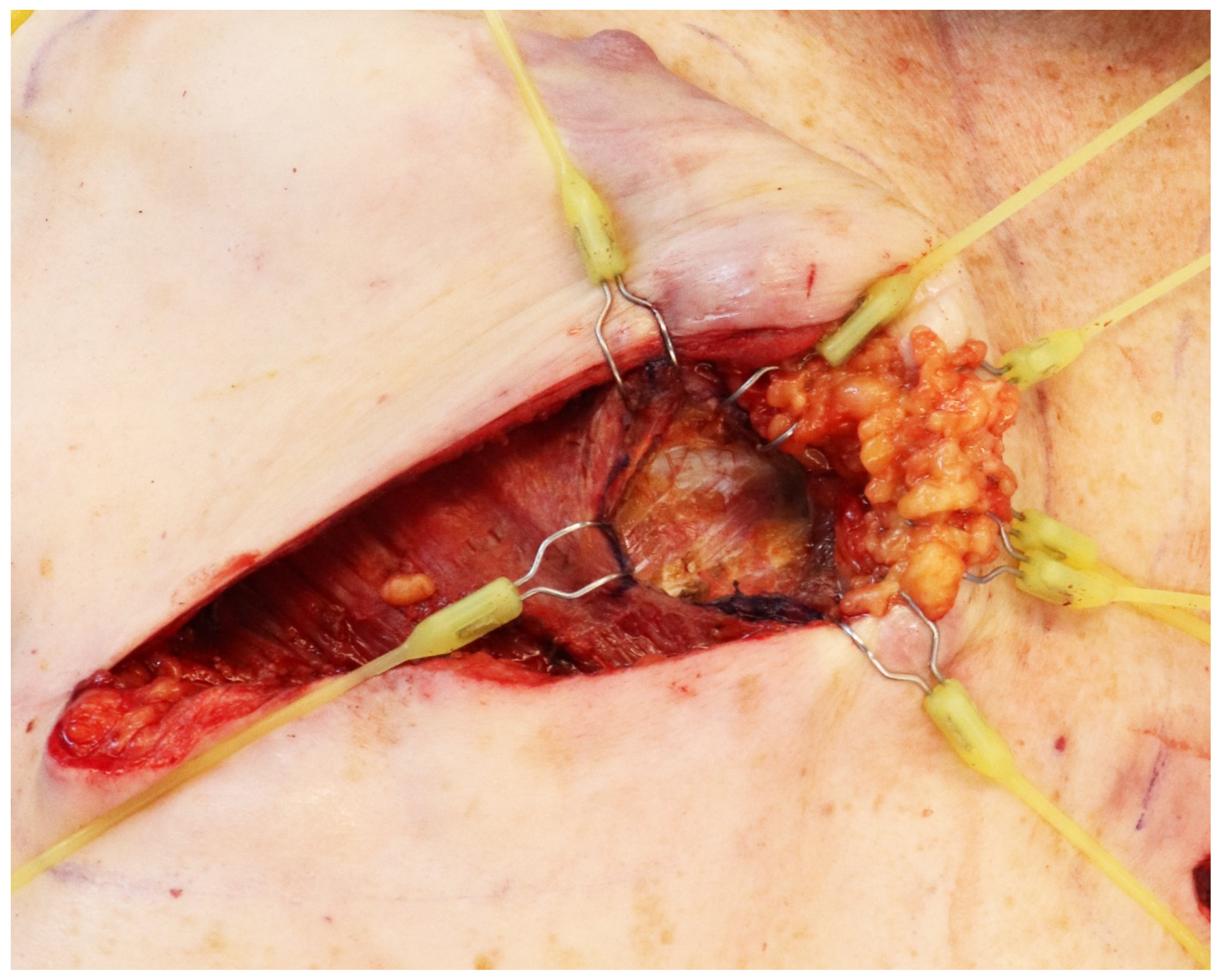 Jcm 14 00602 g001 Jcm 14 00602 g001