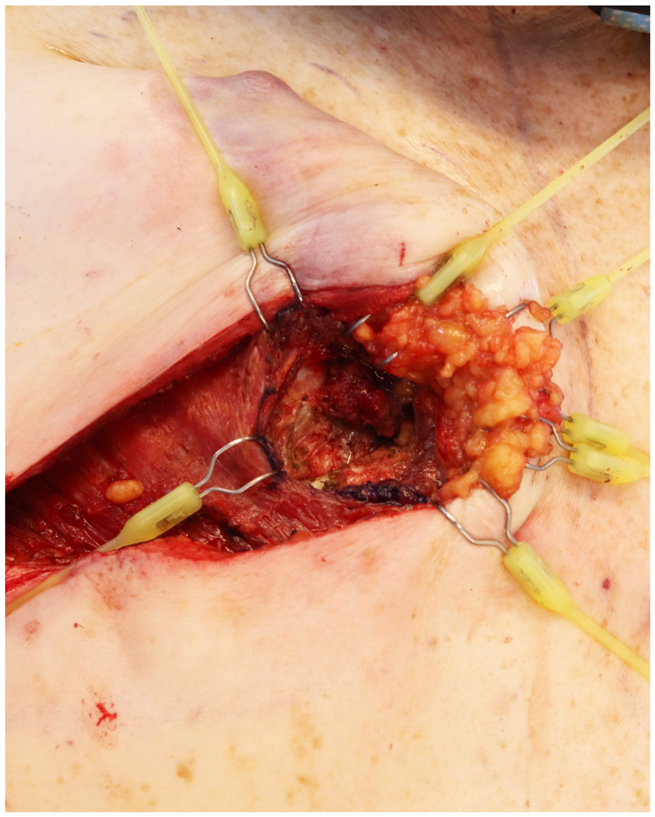 Jcm 14 00602 g002 Jcm 14 00602 g002