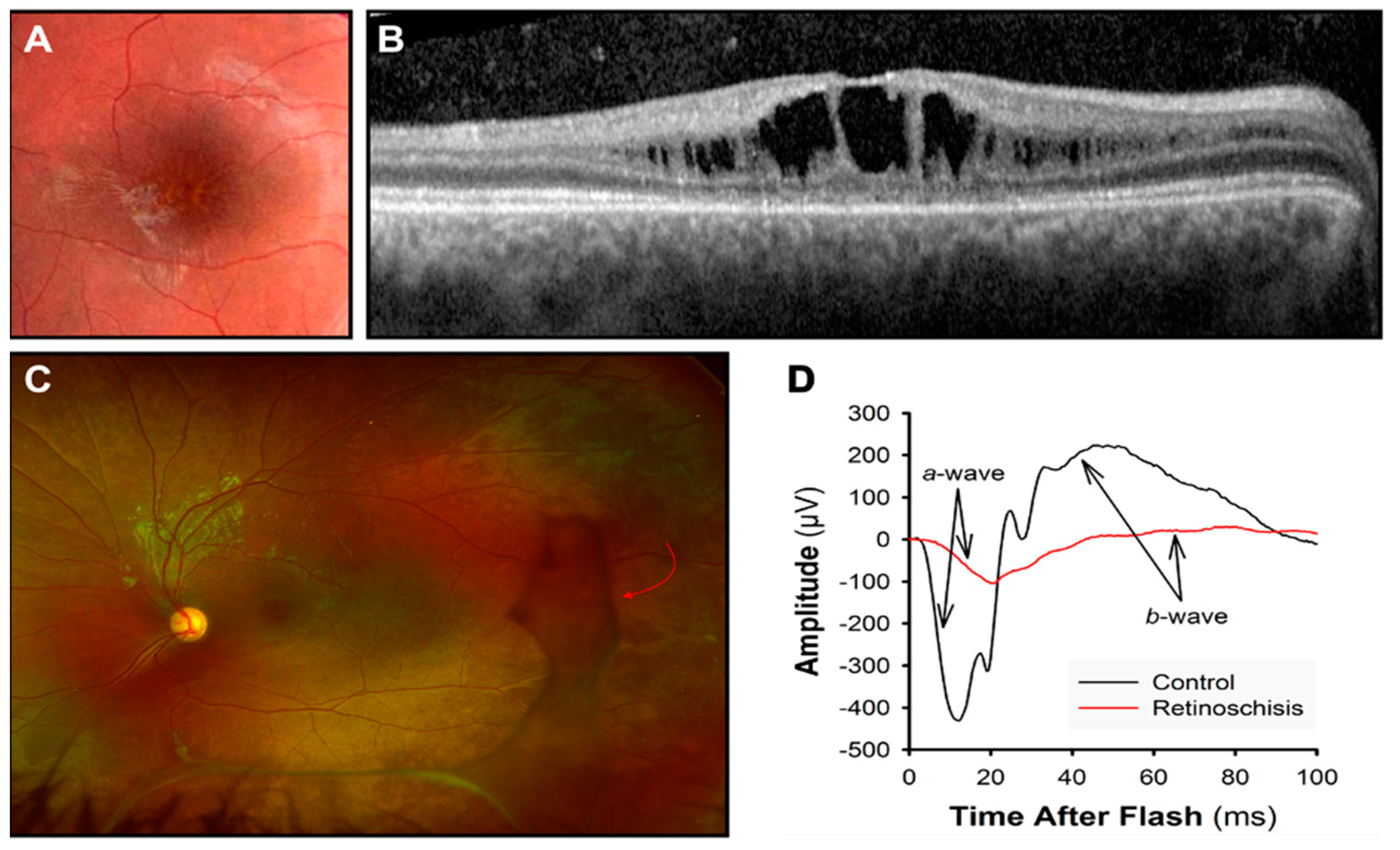 Jcm 14 00614 g004 Jcm 14 00614 g004