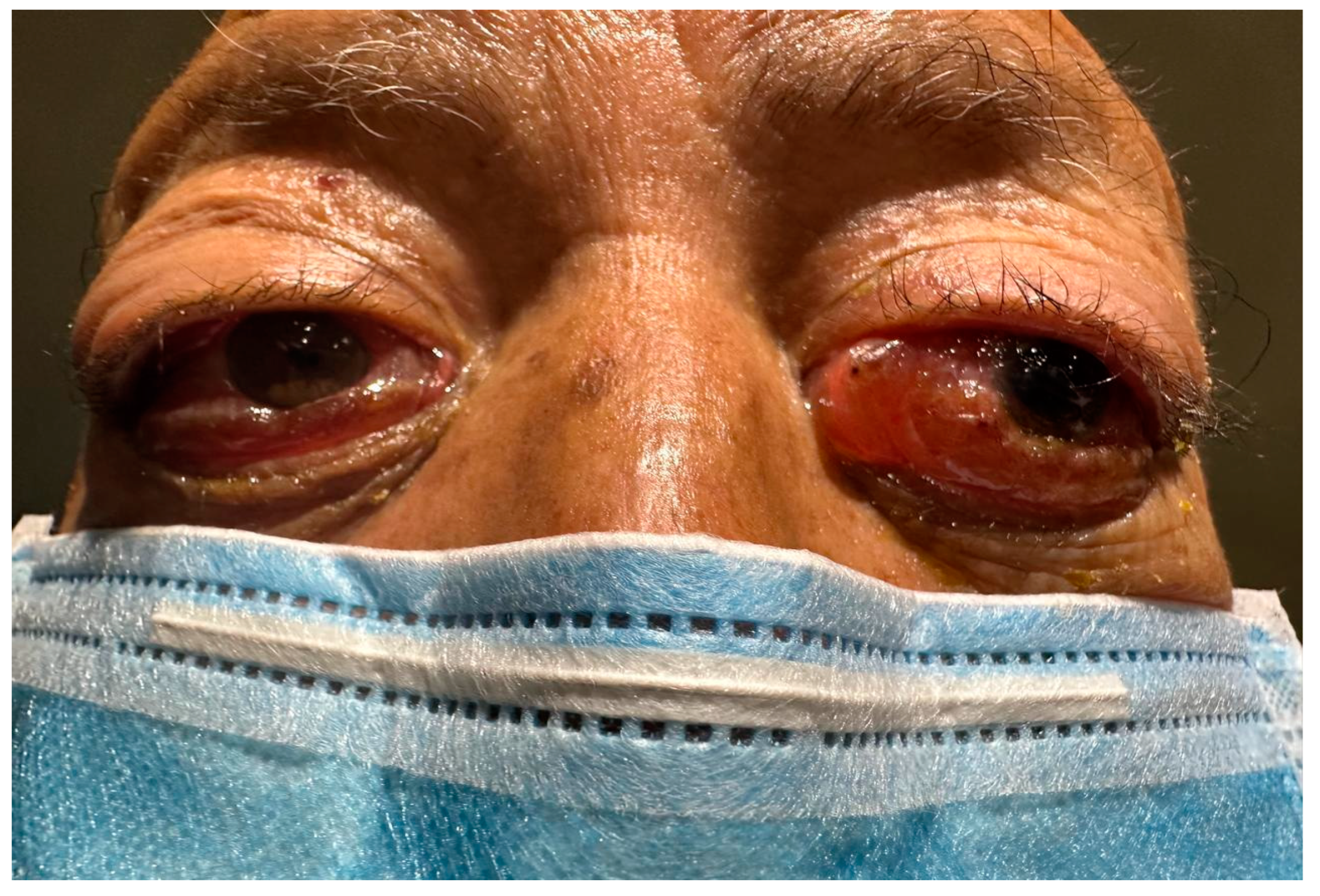 Jcm 14 00958 g001 Jcm 14 00958 g001