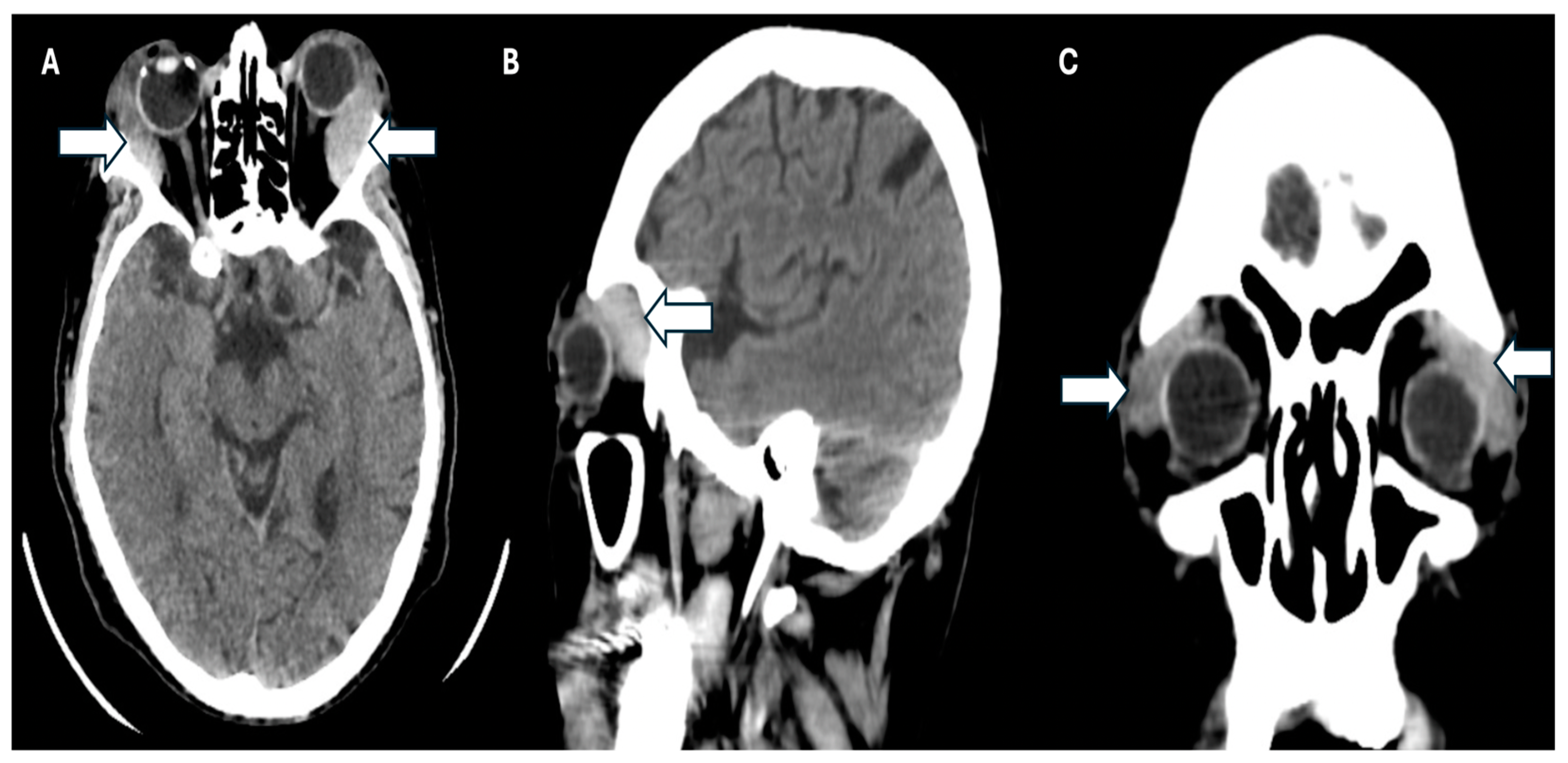Jcm 14 00958 g003 Jcm 14 00958 g003