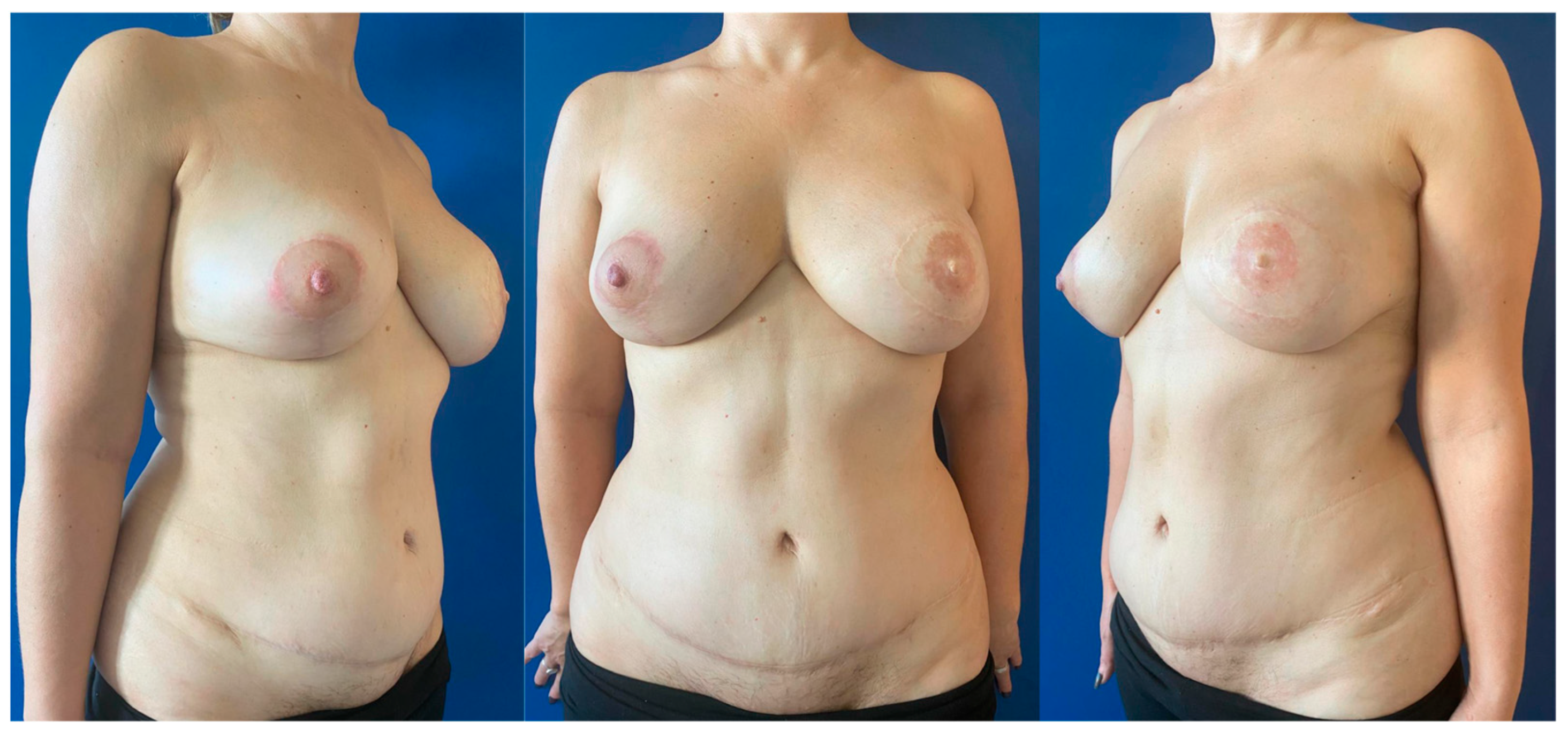 Jcm 14 01056 g001 Jcm 14 01056 g001