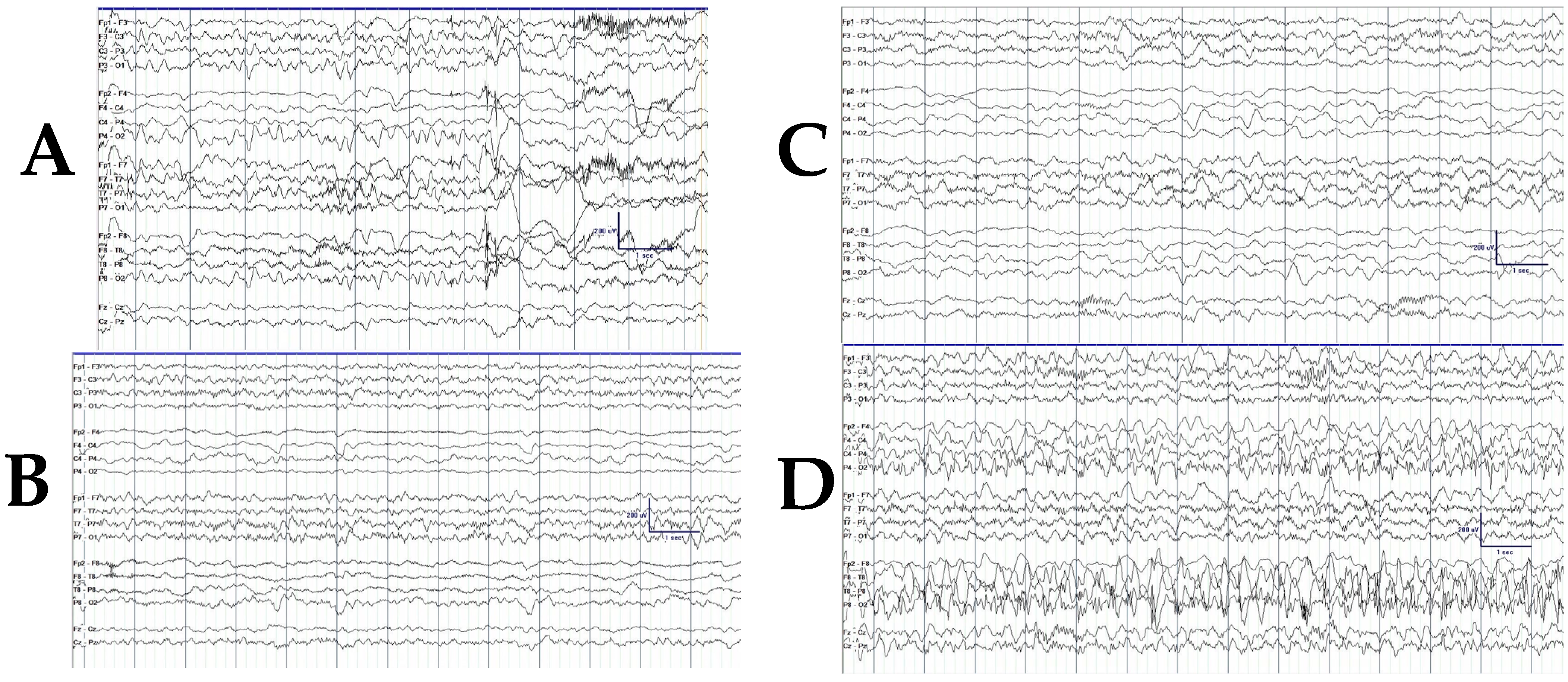 Jcm 14 02182 g001 Jcm 14 02182 g001