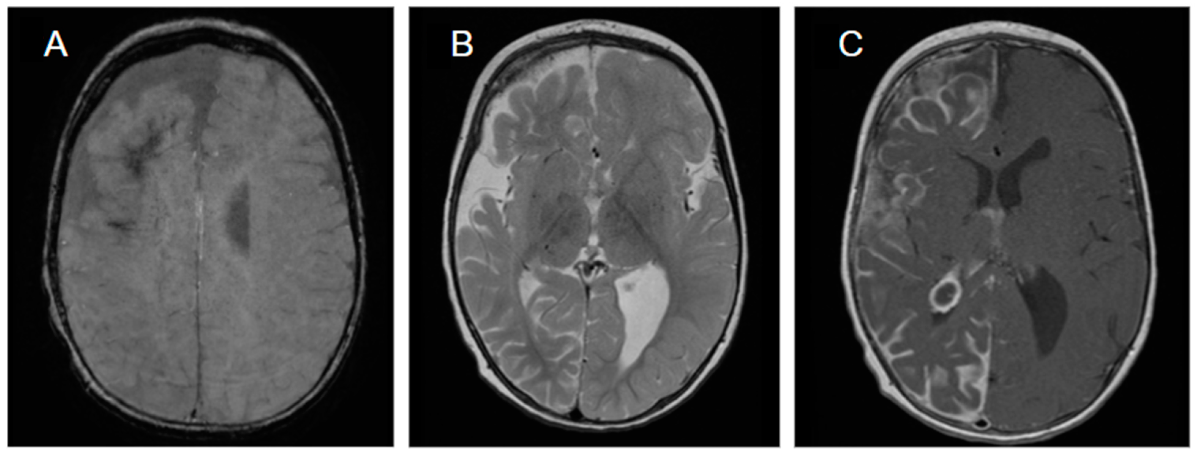 Jcm 14 02182 g002 Jcm 14 02182 g002