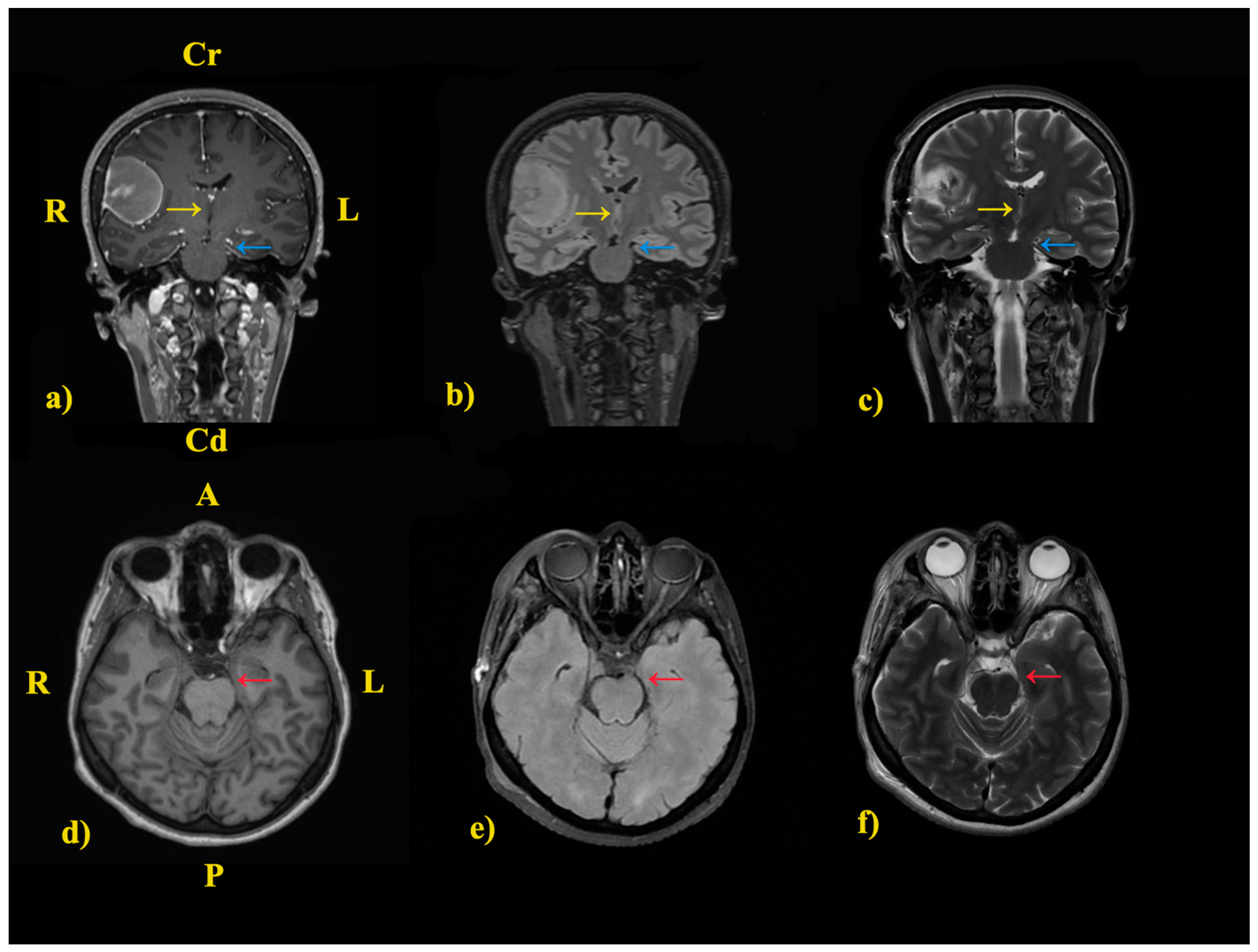 Jcm 14 02689 g006