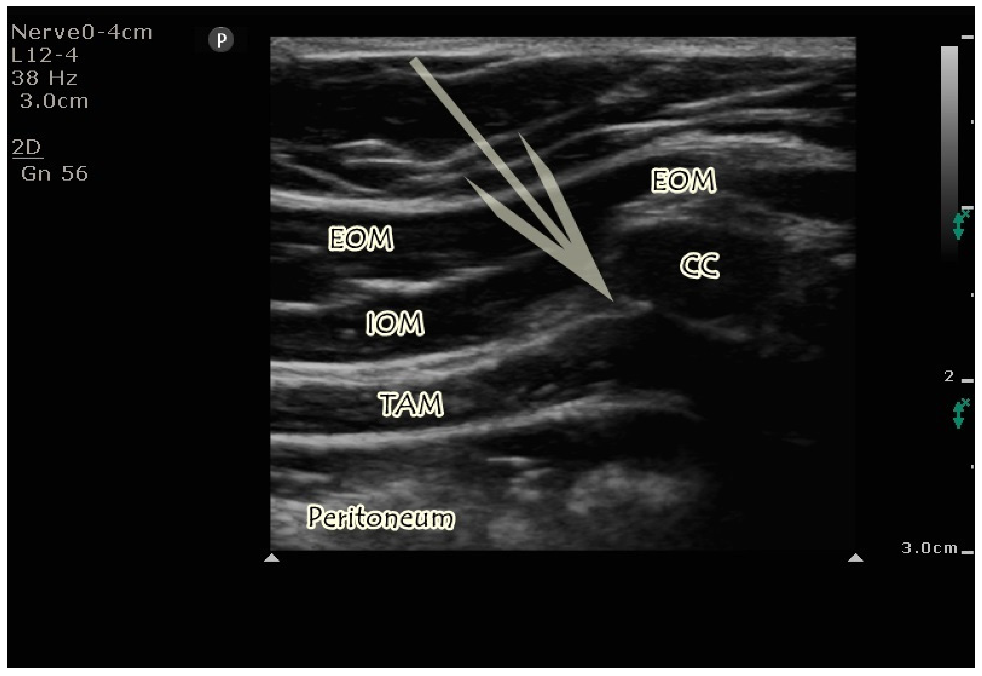 Jcm 14 03050 g001 Jcm 14 03050 g001
