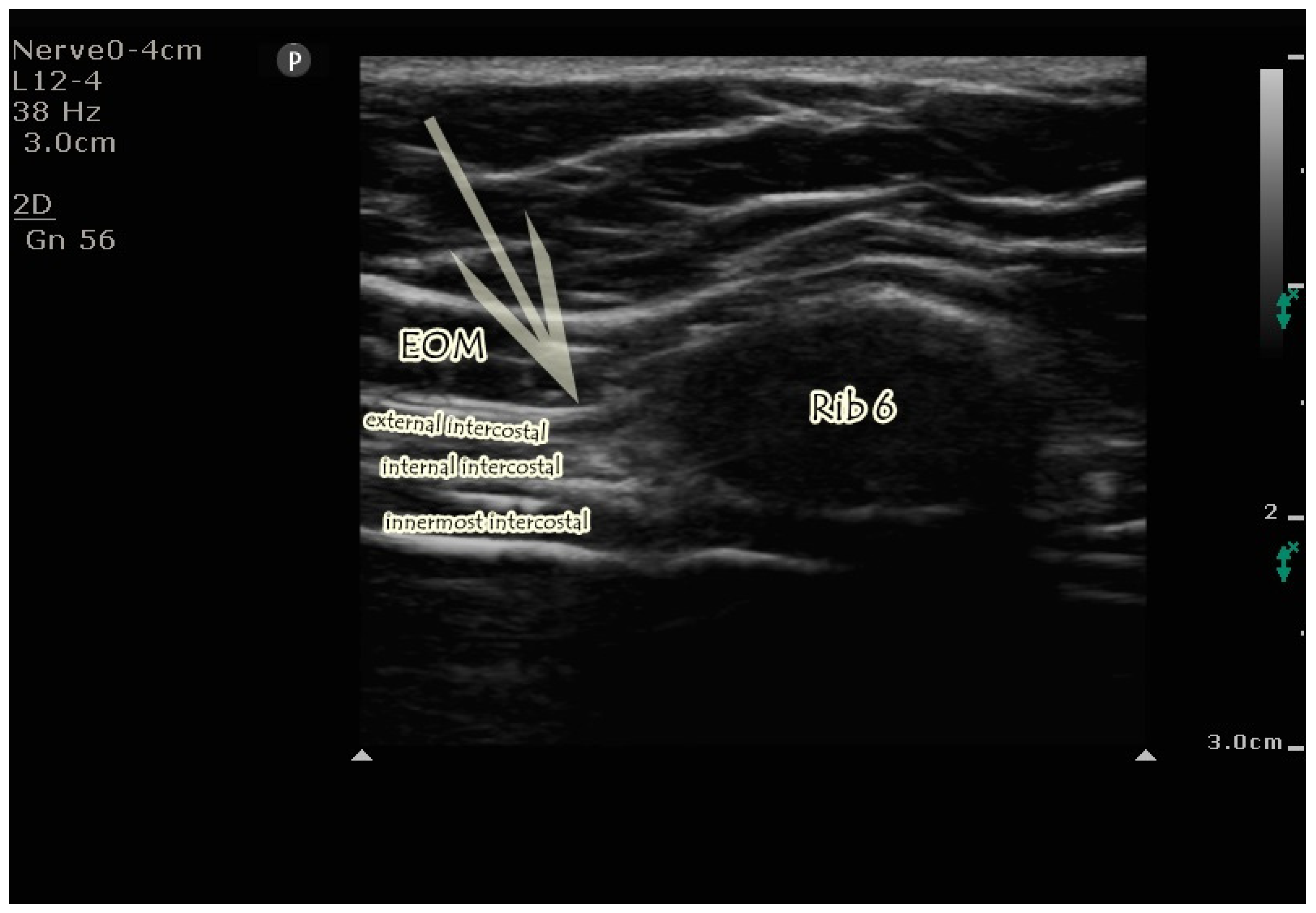 Jcm 14 03050 g002 Jcm 14 03050 g002