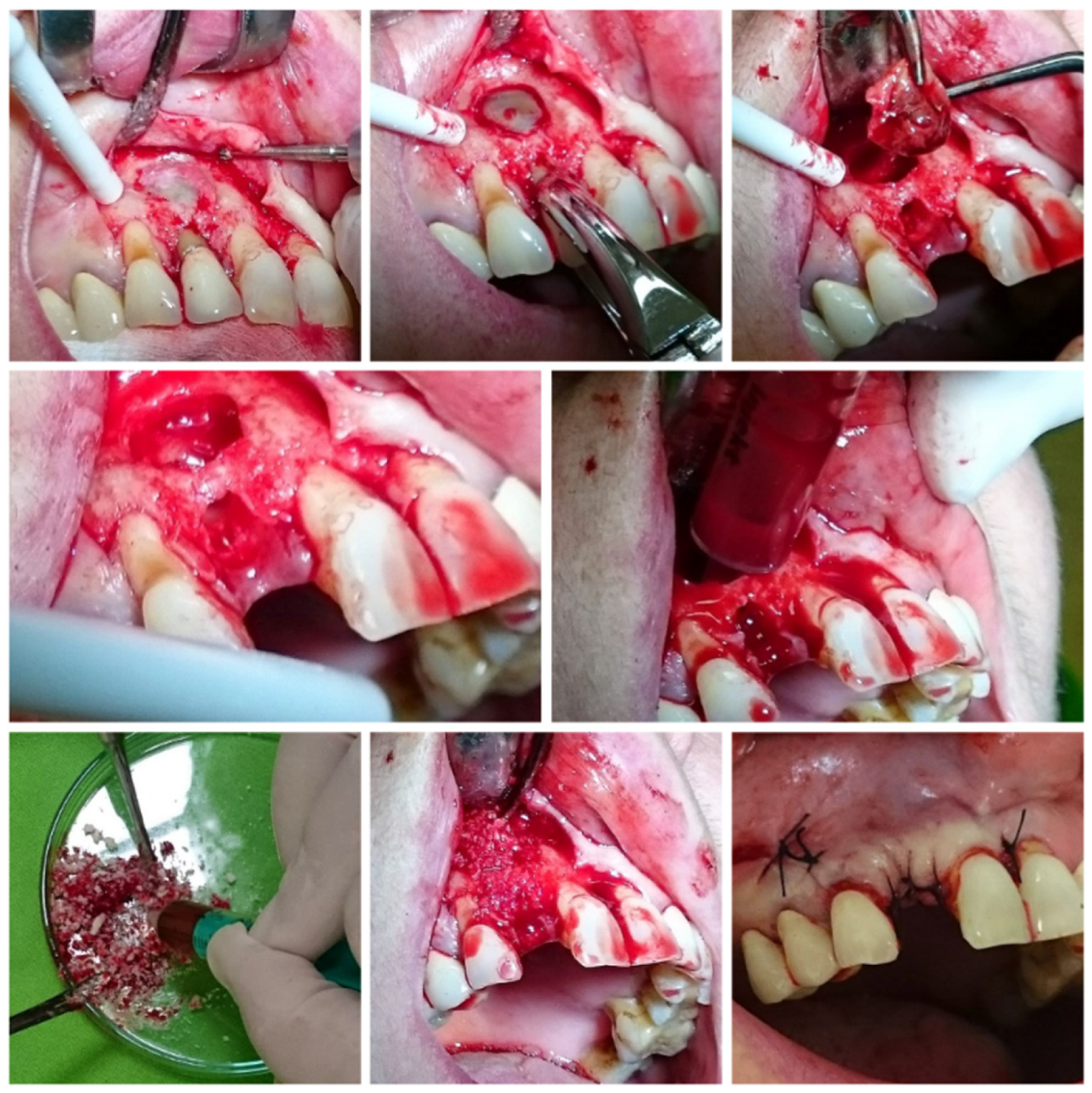 Jcm 14 04173 g001 Jcm 14 04173 g001