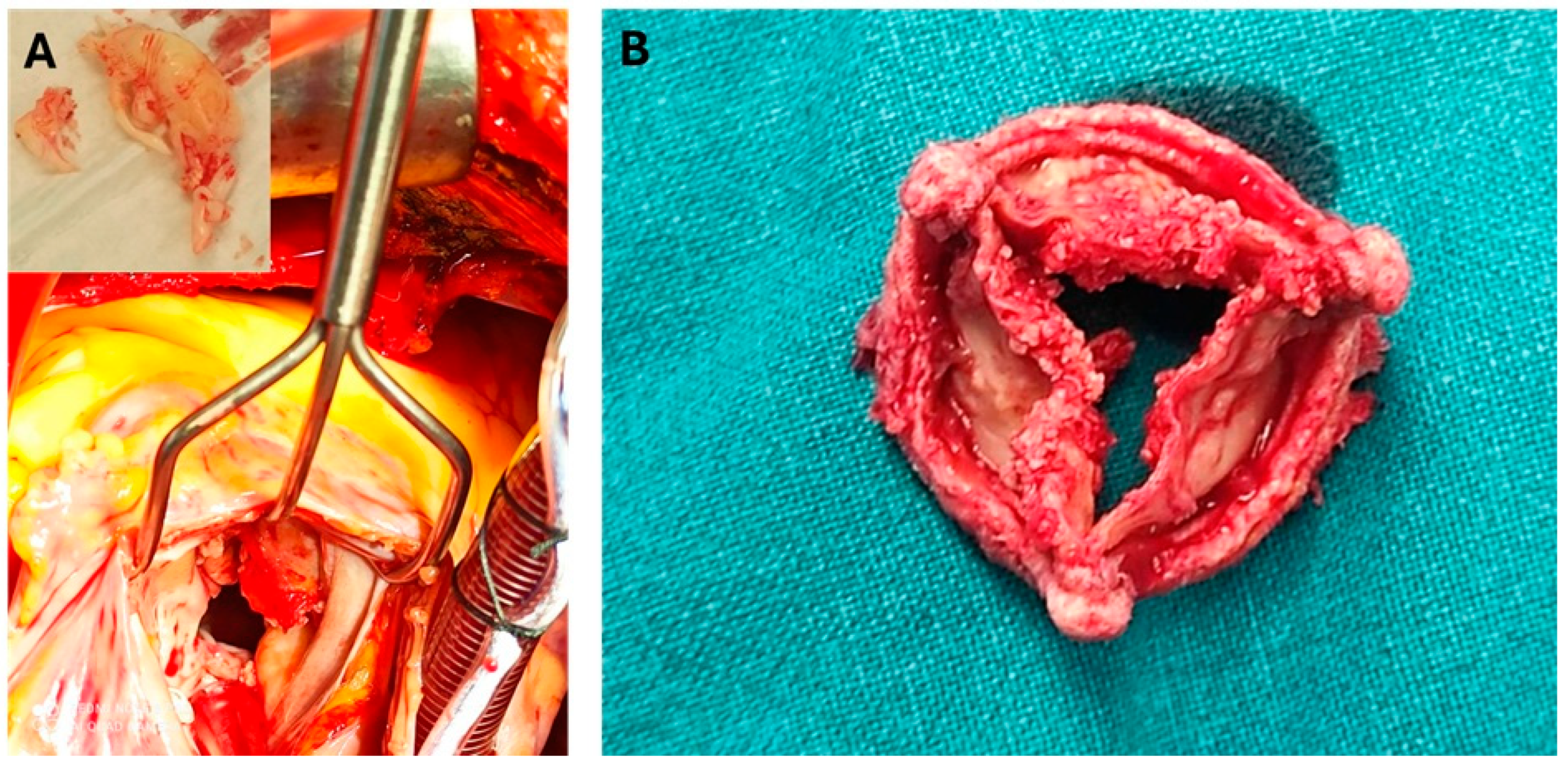 Jcm 14 04262 g004 Jcm 14 04262 g004