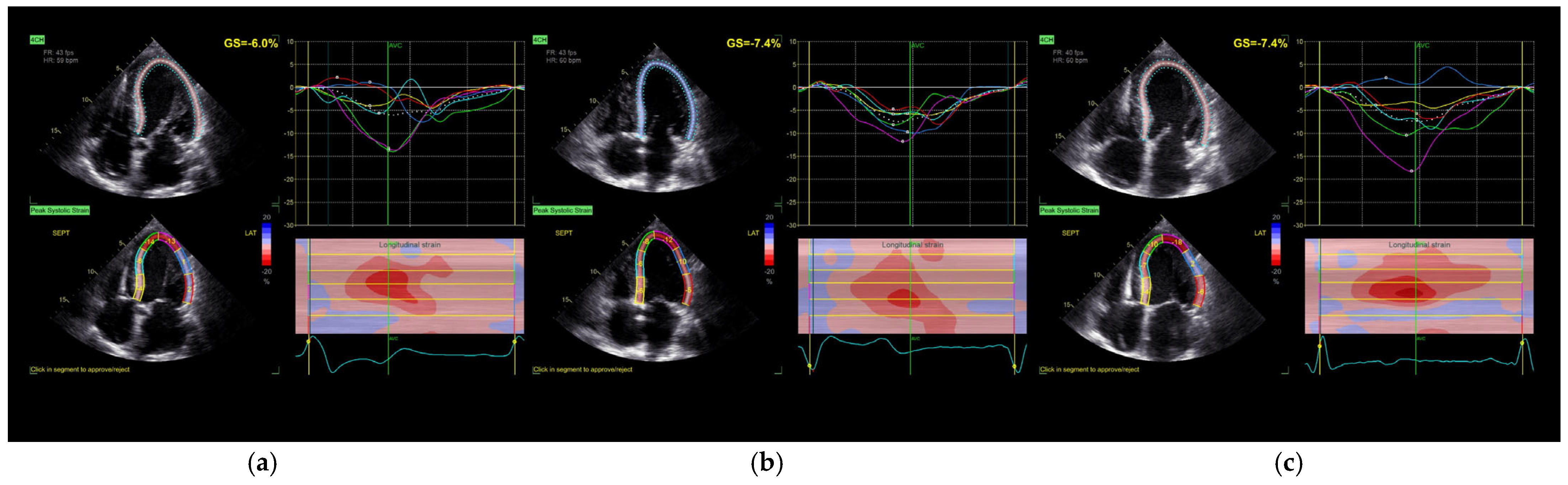 Jcm 14 04433 g001 Jcm 14 04433 g001