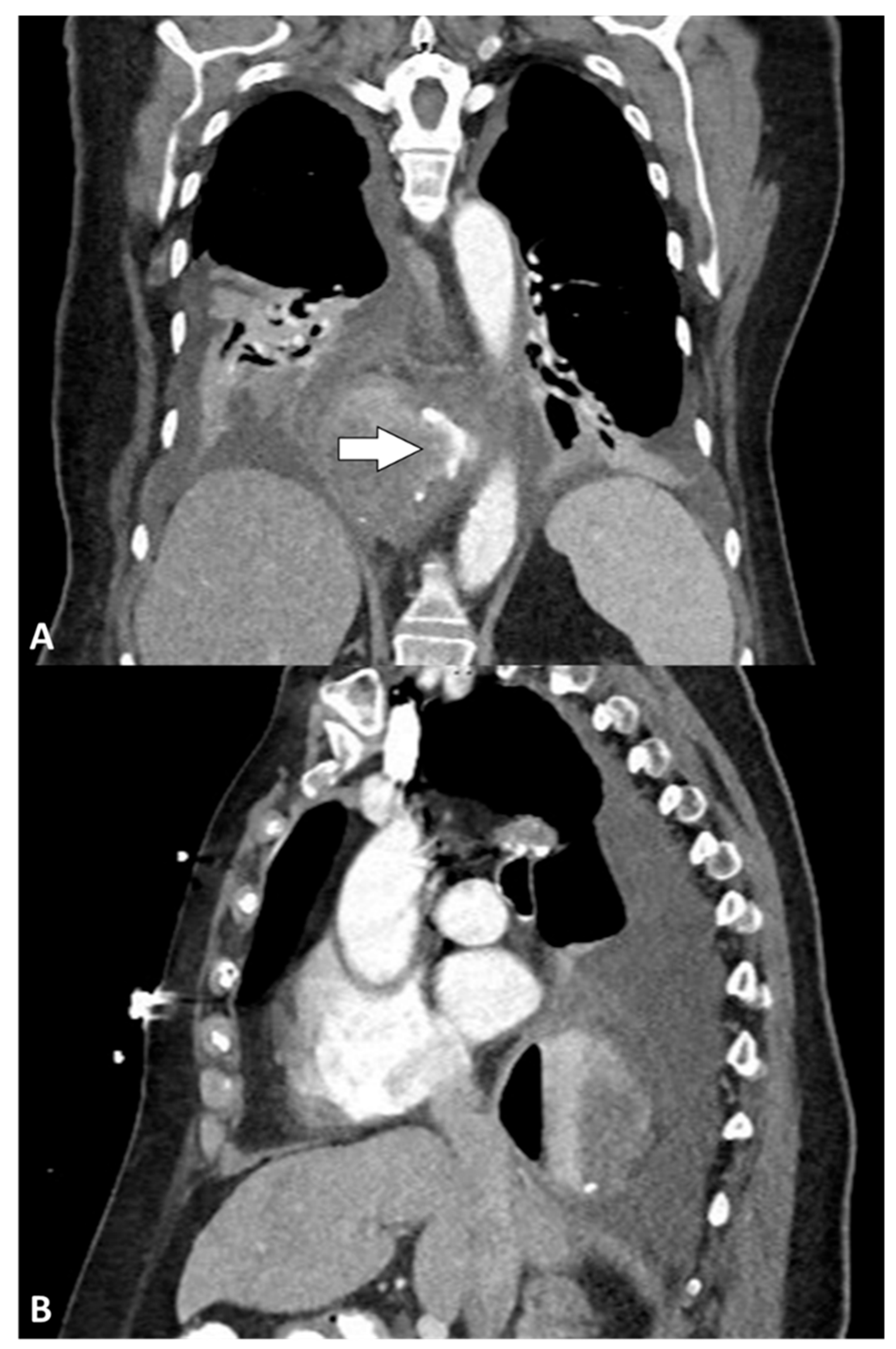 Jcm 14 04577 g001 Jcm 14 04577 g001