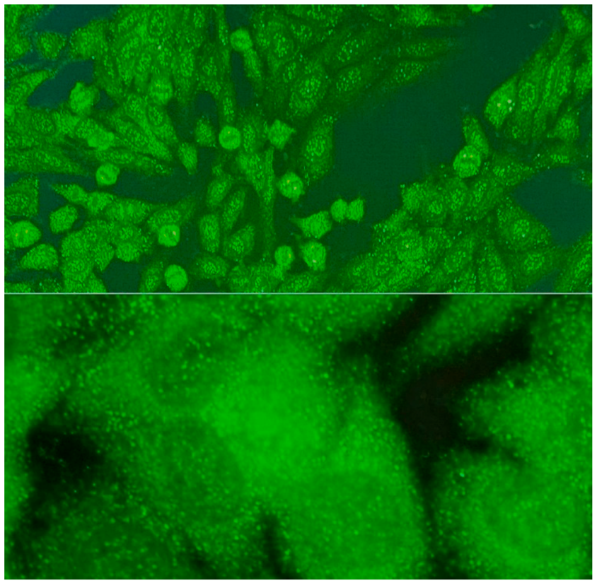 Jcm 14 05322 i008 Jcm 14 05322 i008