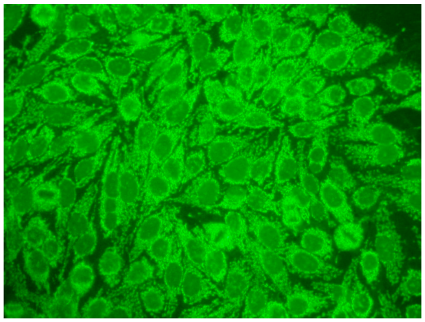 Jcm 14 05322 i013 Jcm 14 05322 i013