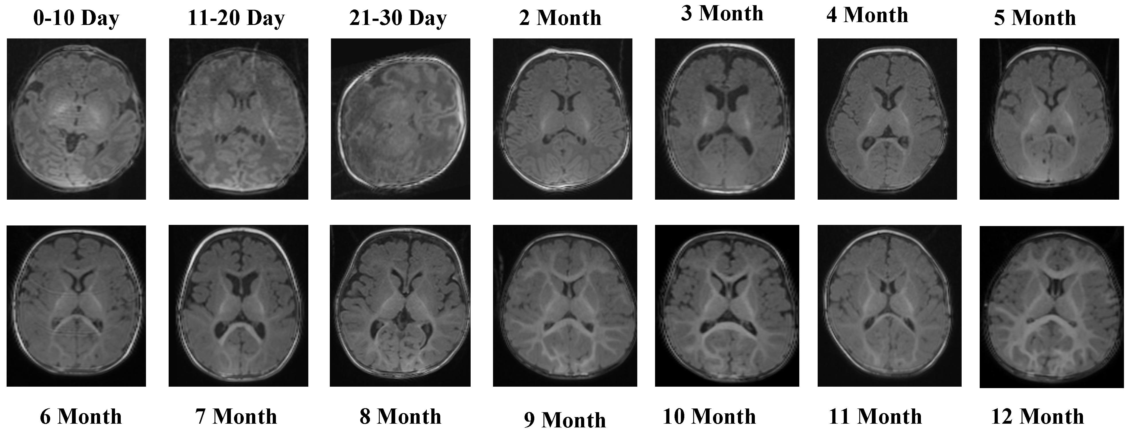 Jcm 14 07299 g002 Jcm 14 07299 g002
