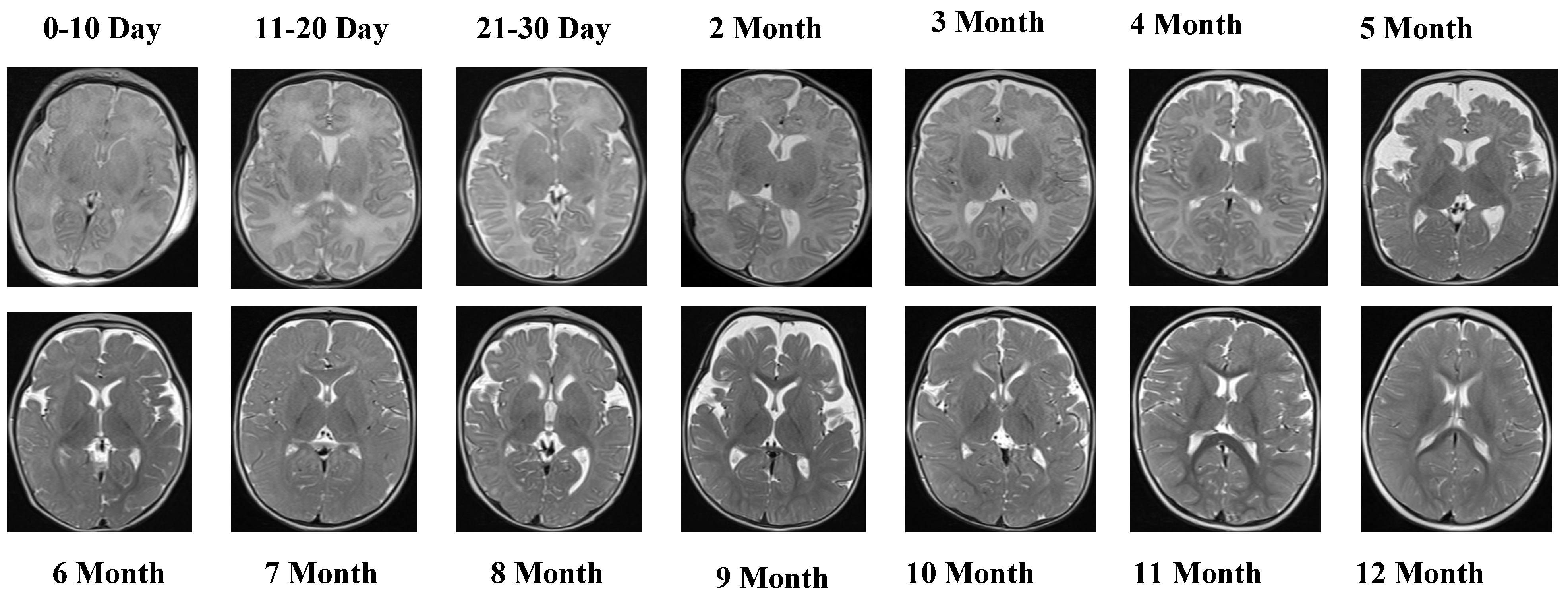 Jcm 14 07299 g003 Jcm 14 07299 g003