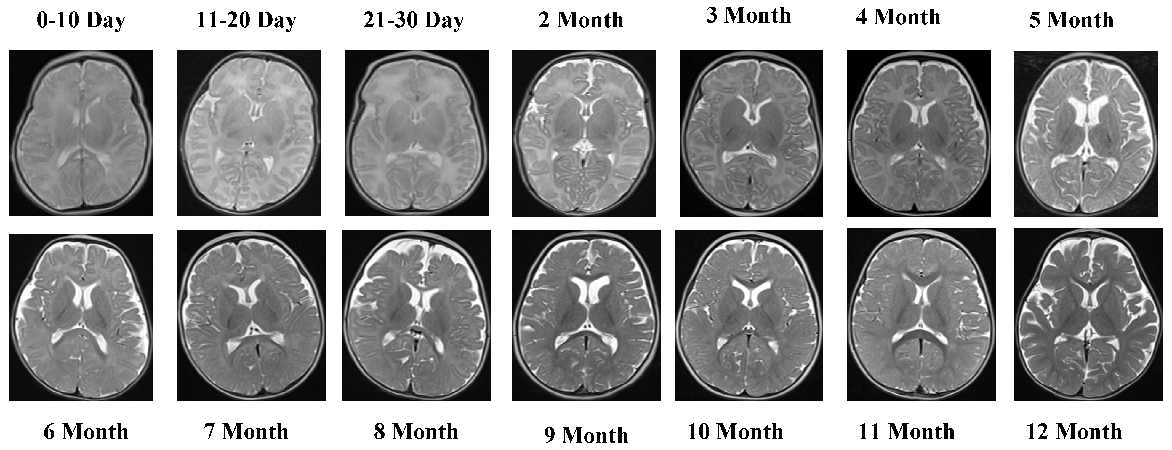 Jcm 14 07299 g004 Jcm 14 07299 g004