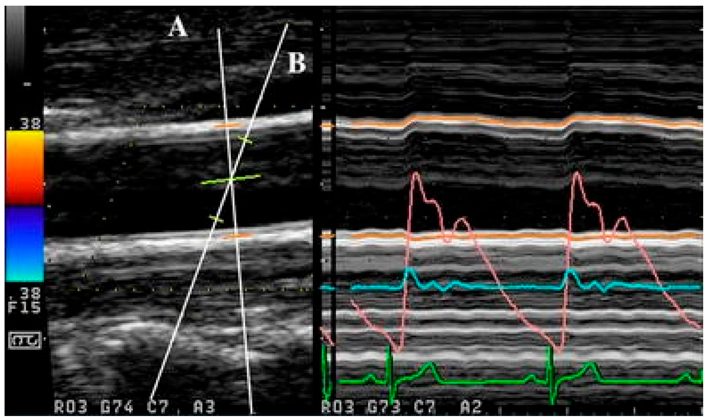 Jcm 14 07550 g004 Jcm 14 07550 g004